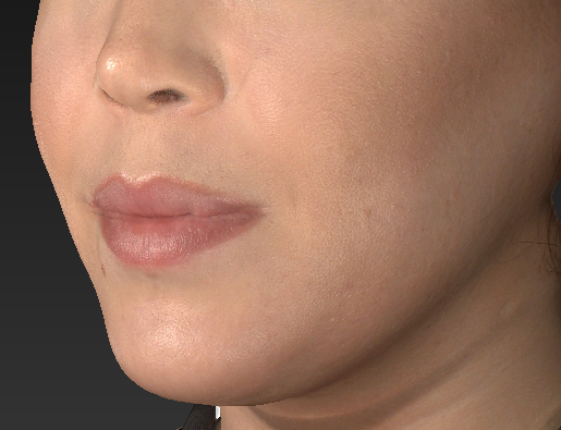 Patient 46 Before Image