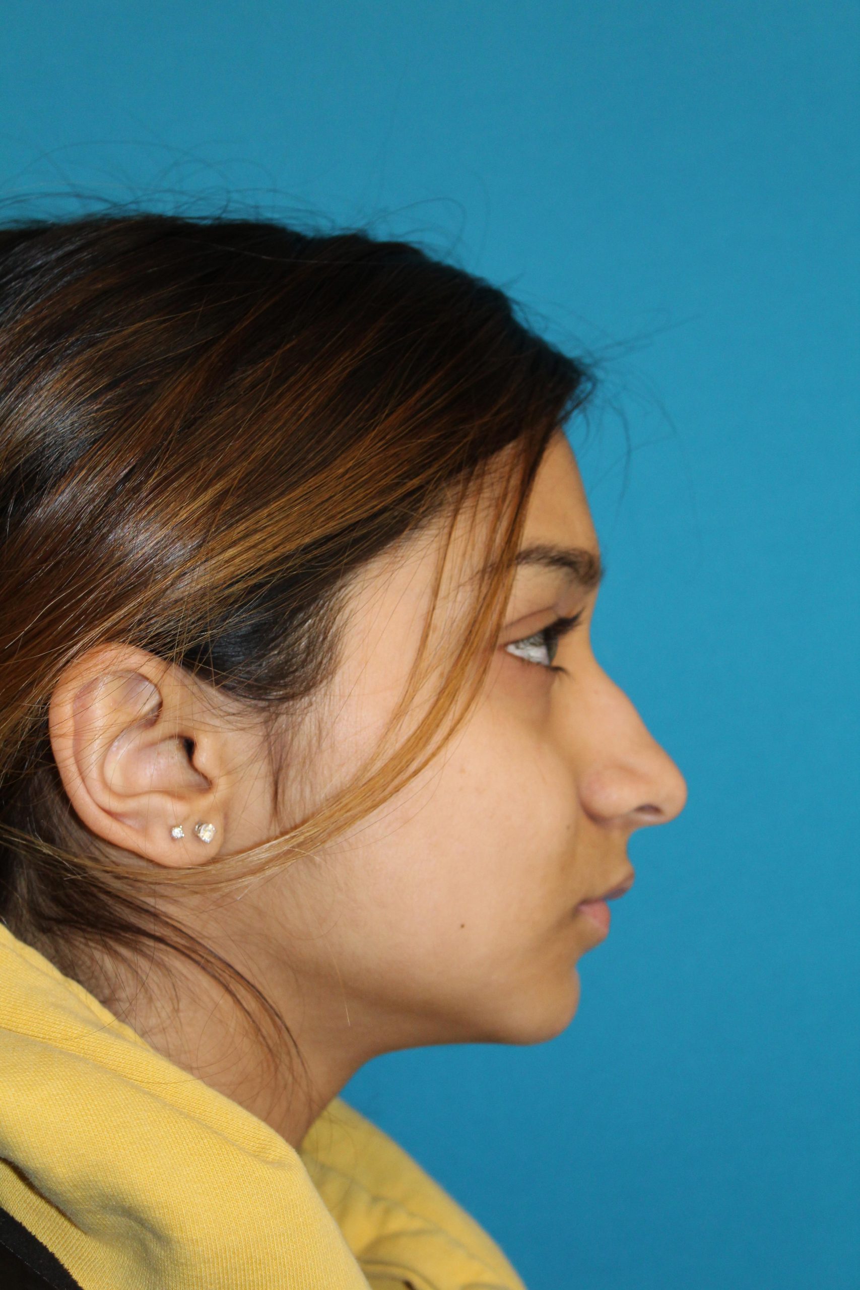 Patient 40 Before Image