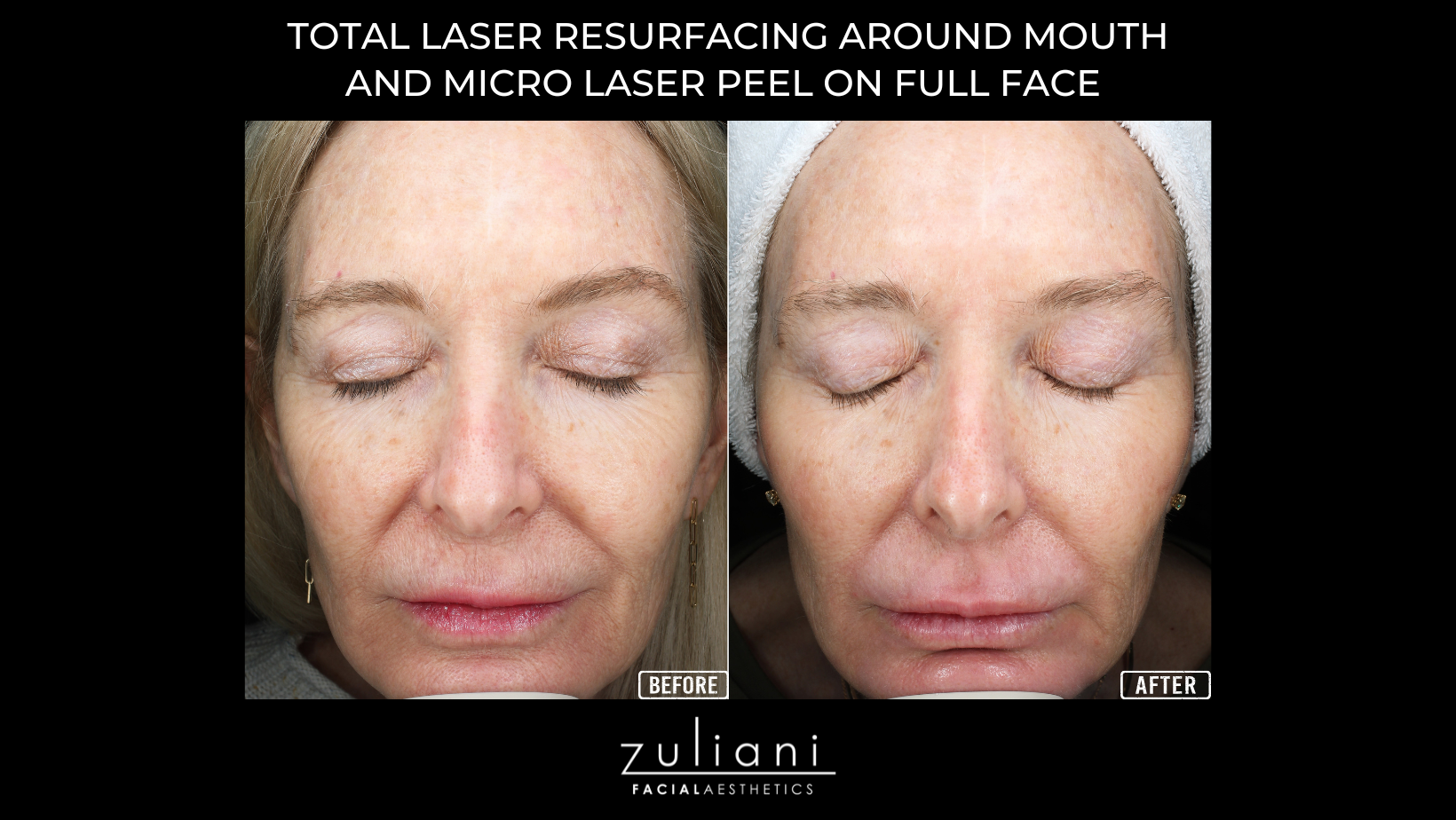 Untitled Marge Image