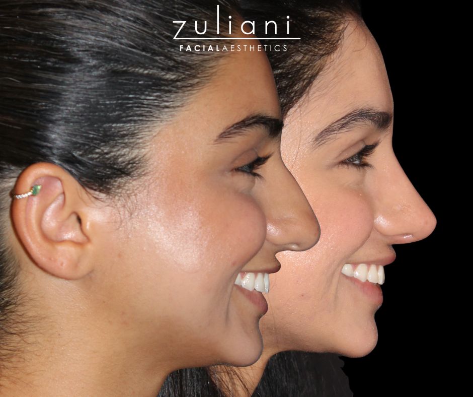 Patient #188 Marge Image