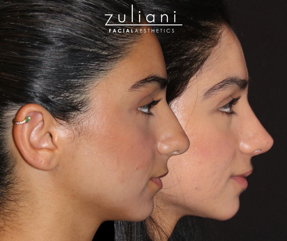 Patient #188 Marge Image