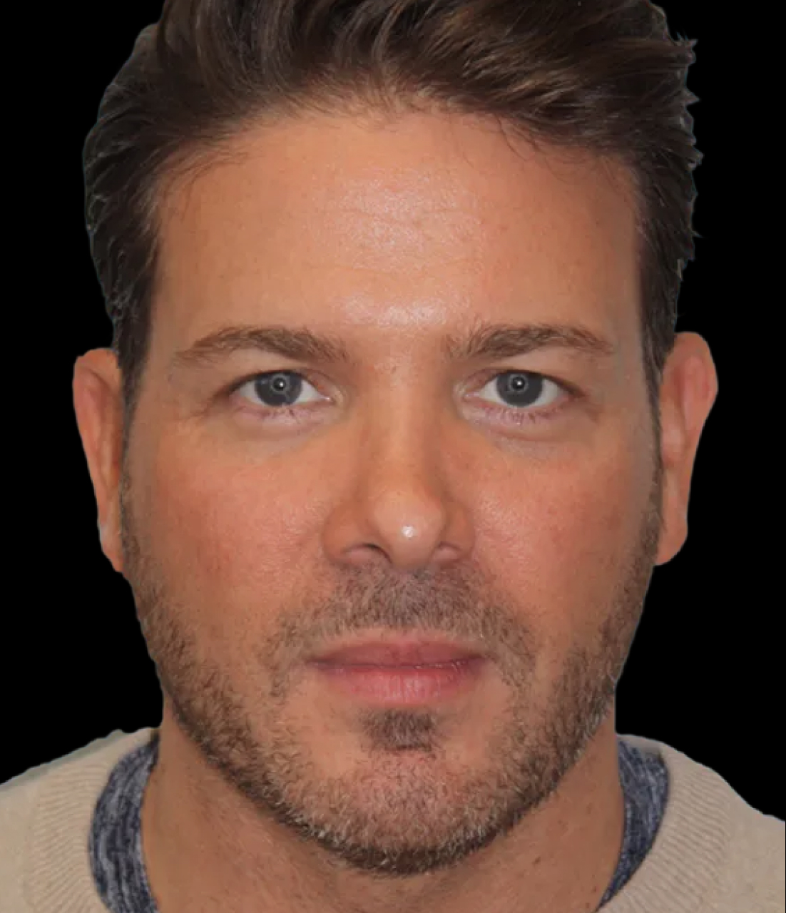 Patient 3 Before Image