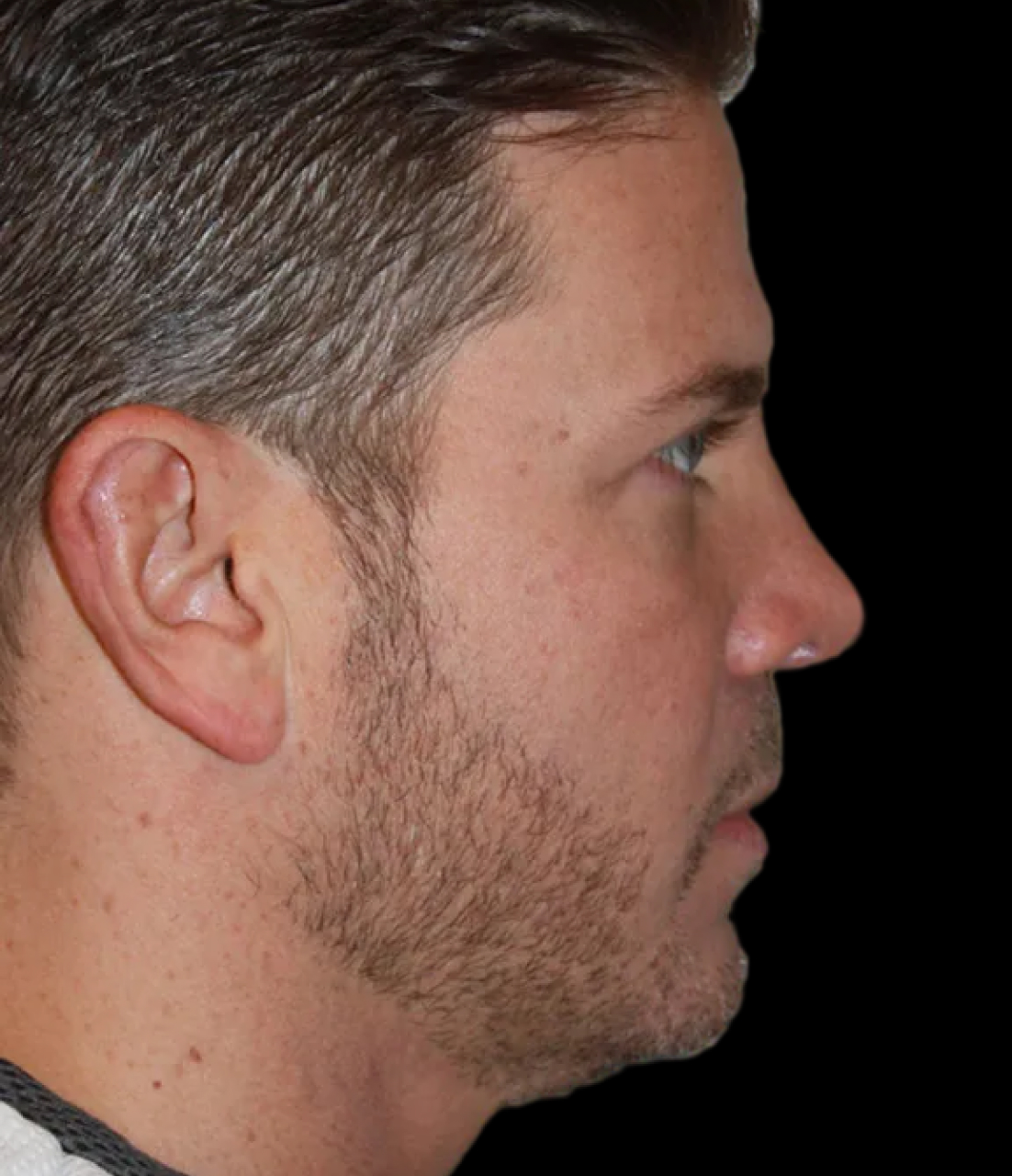 Patient 3 After Image