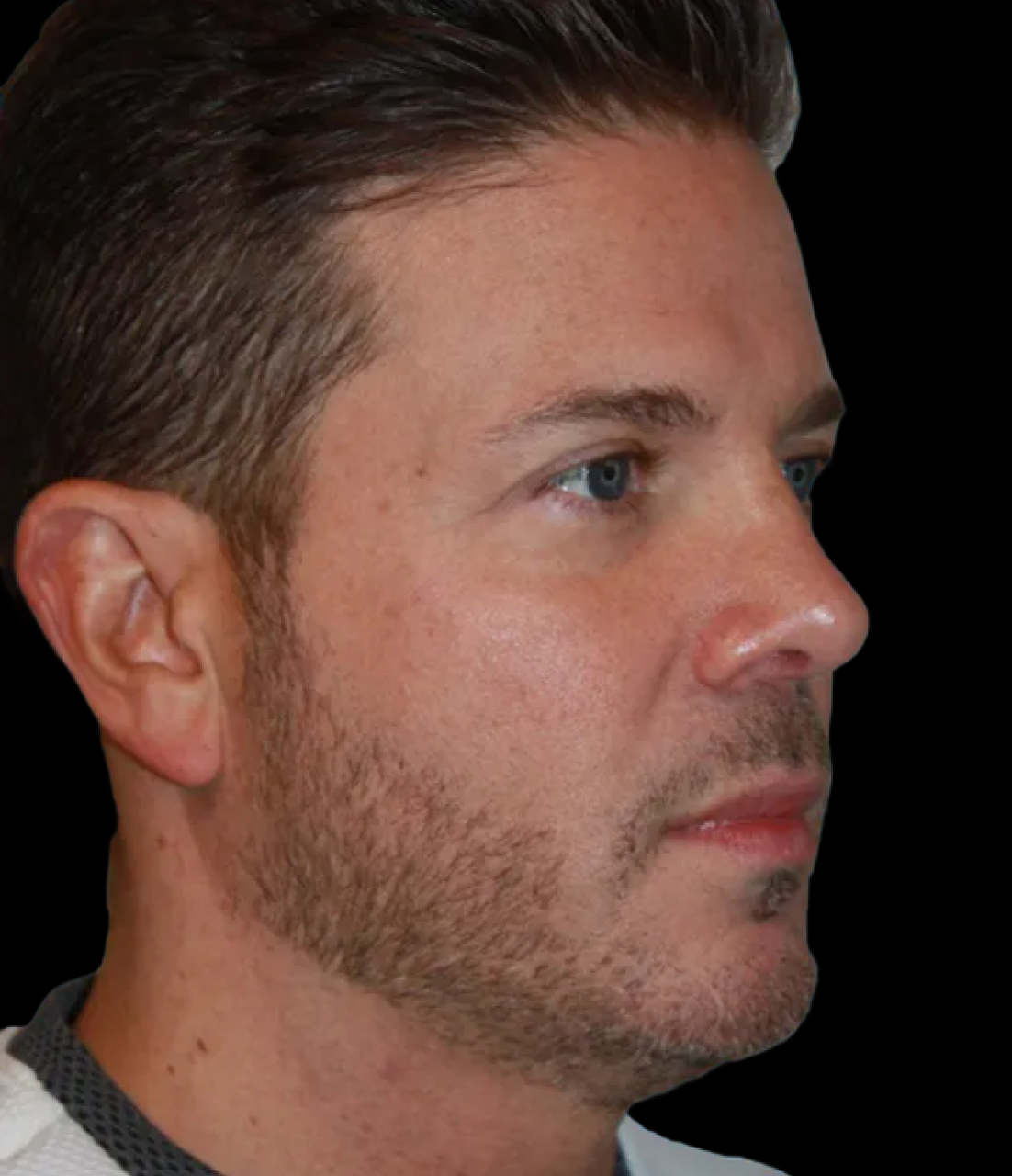 Patient 3 After Image