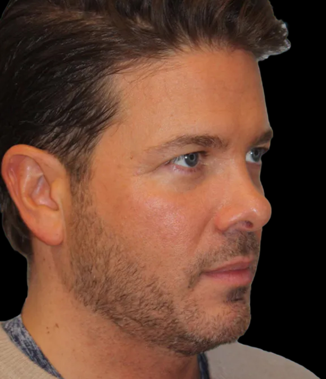 Patient 3 Before Image