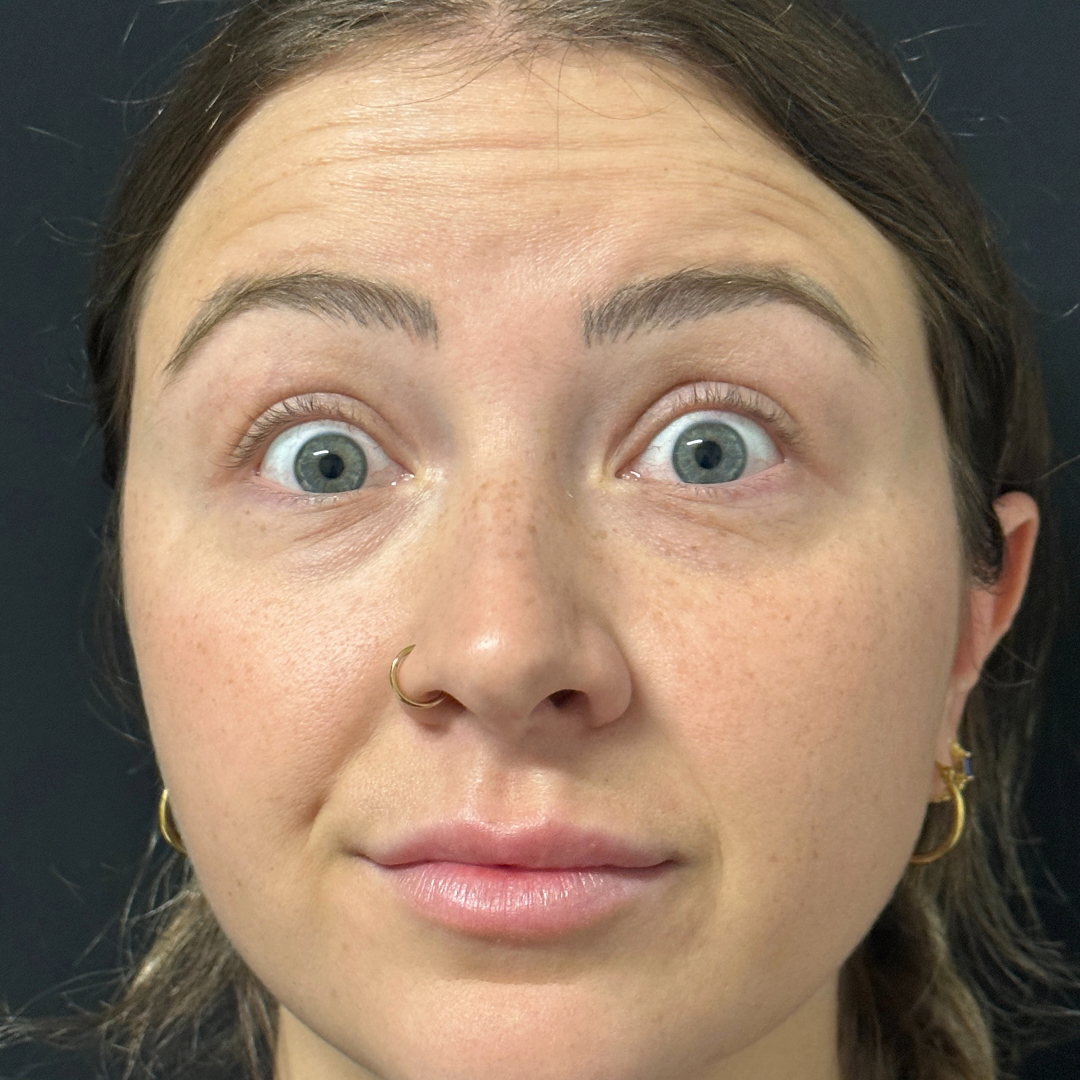 Patient #109 Before Image