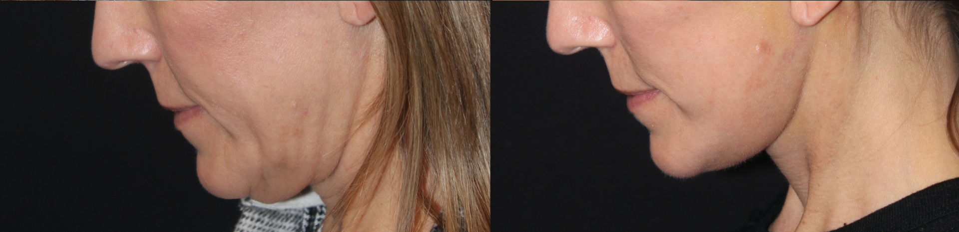 Patient #122 Marge Image