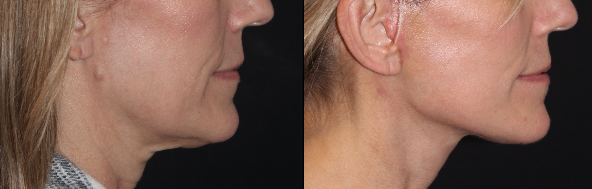 Patient #122 Marge Image