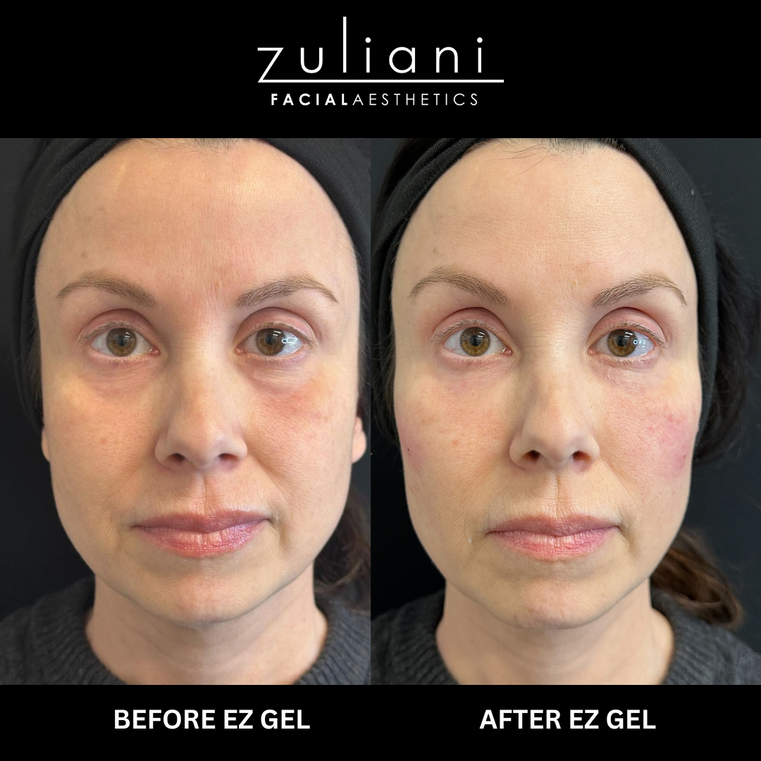 Patient #112 Marge Image