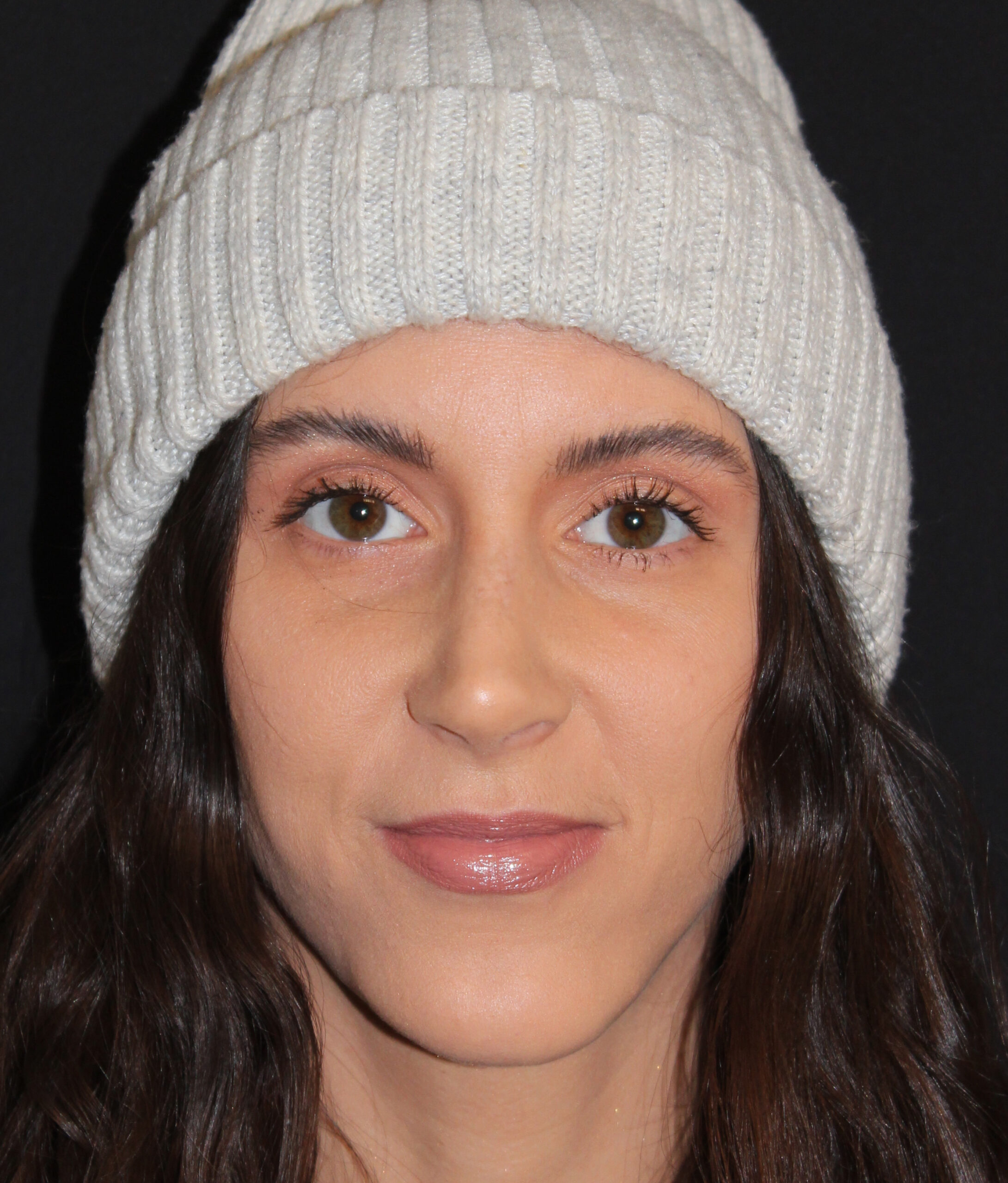 Patient 104 After Image