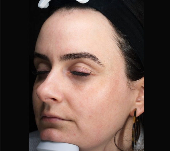 Patient 28 After Image