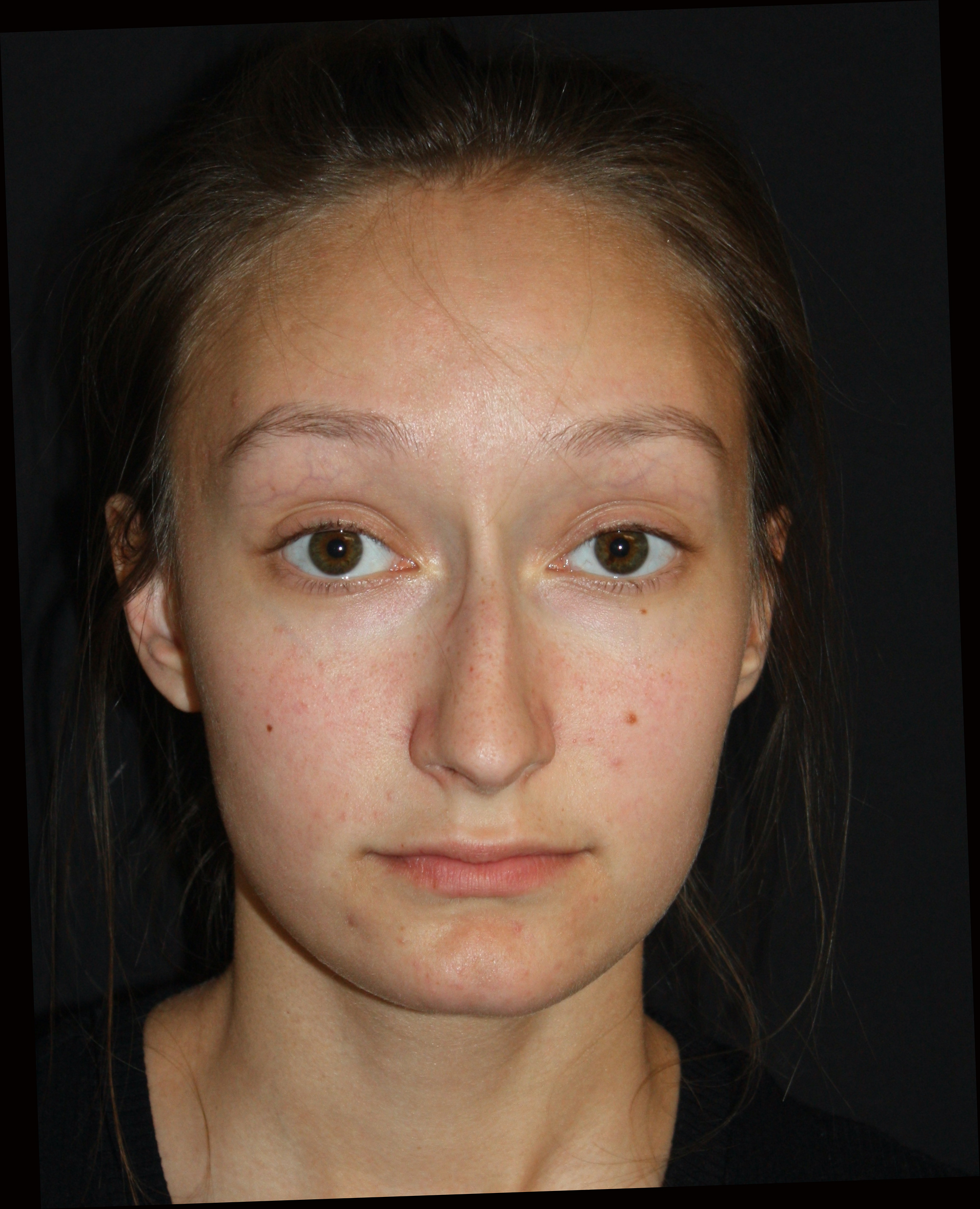 Patient 76 Before Image