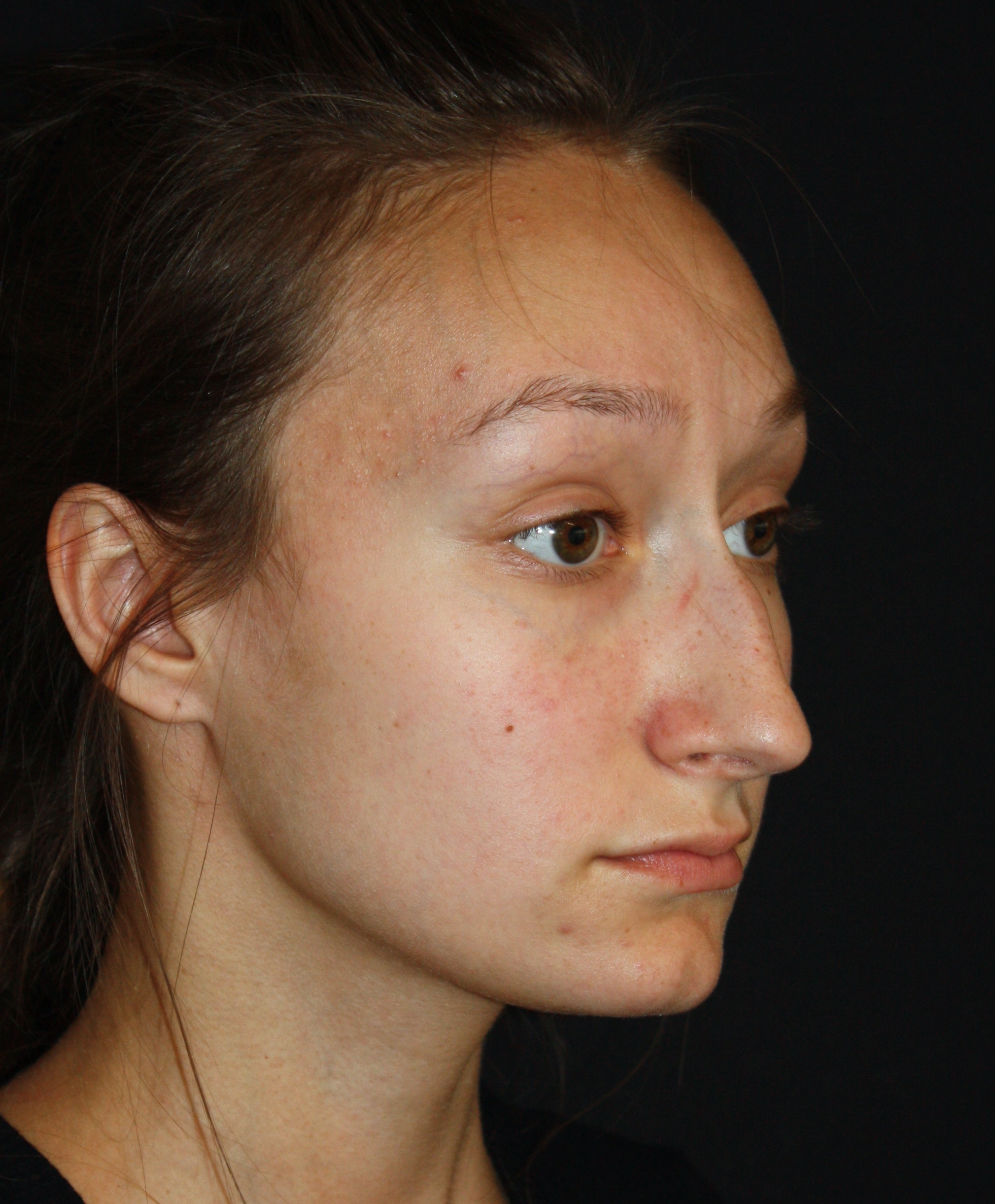 Patient 76 Before Image