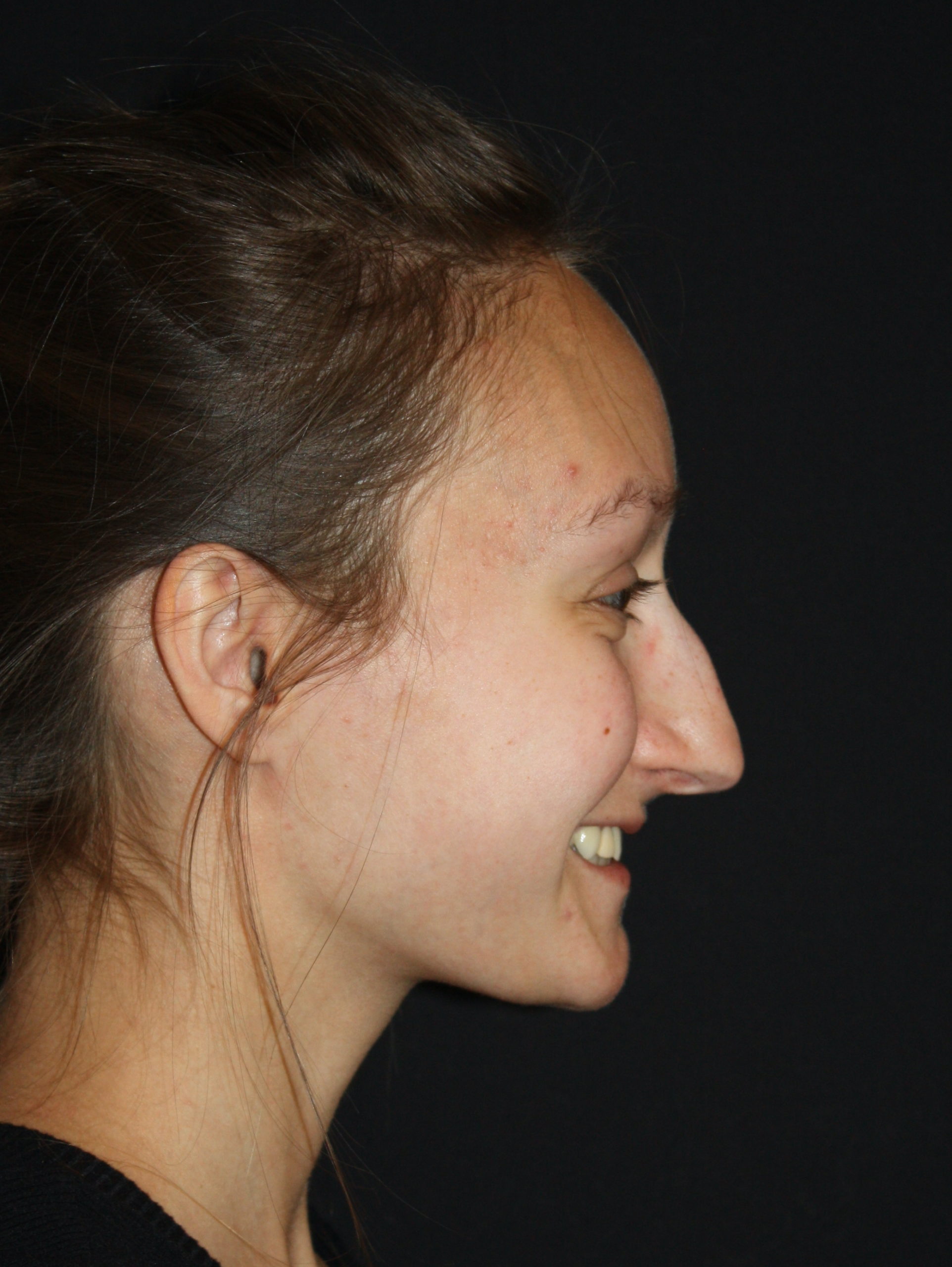 Patient 76 Before Image