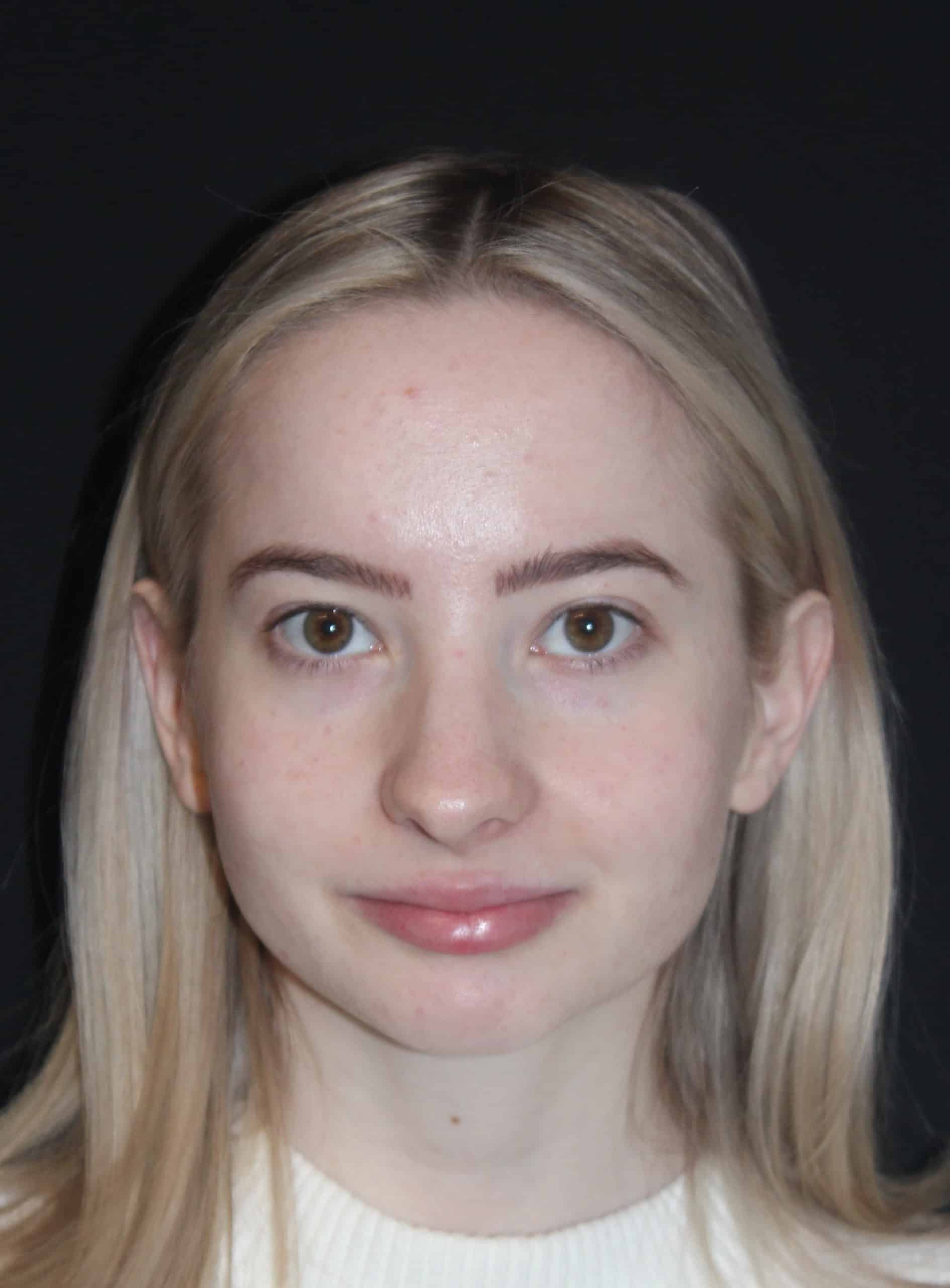 Patient 87 Before Image