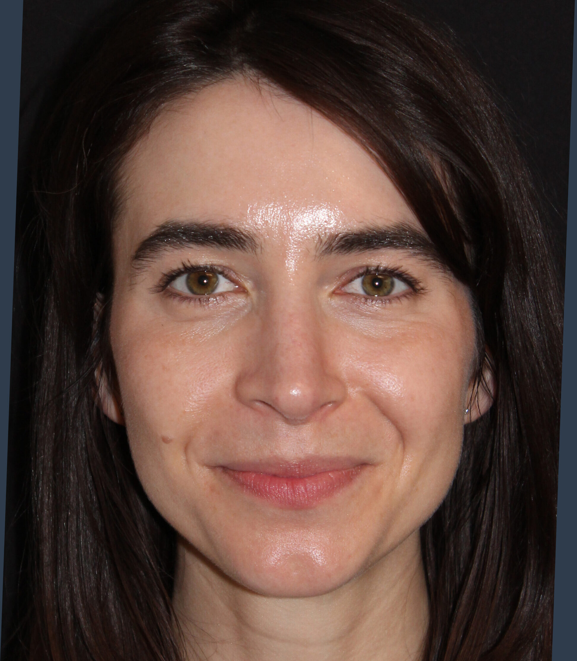 Patient #180 After Image