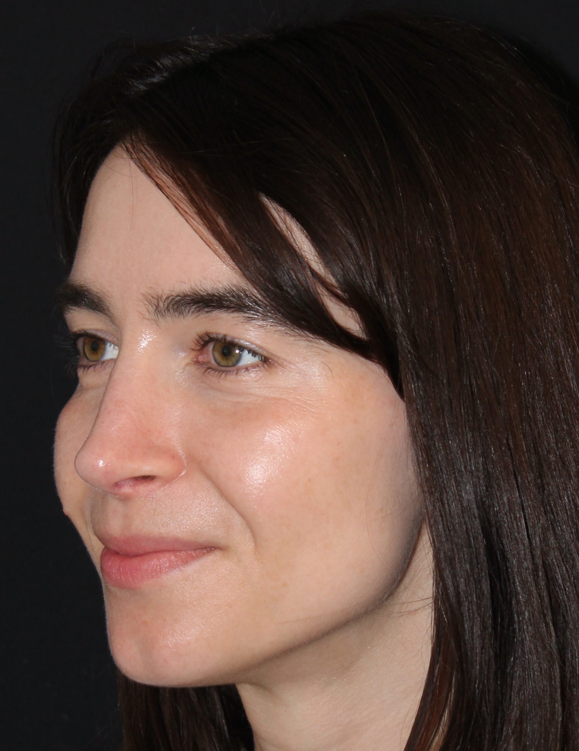 Patient #180 After Image