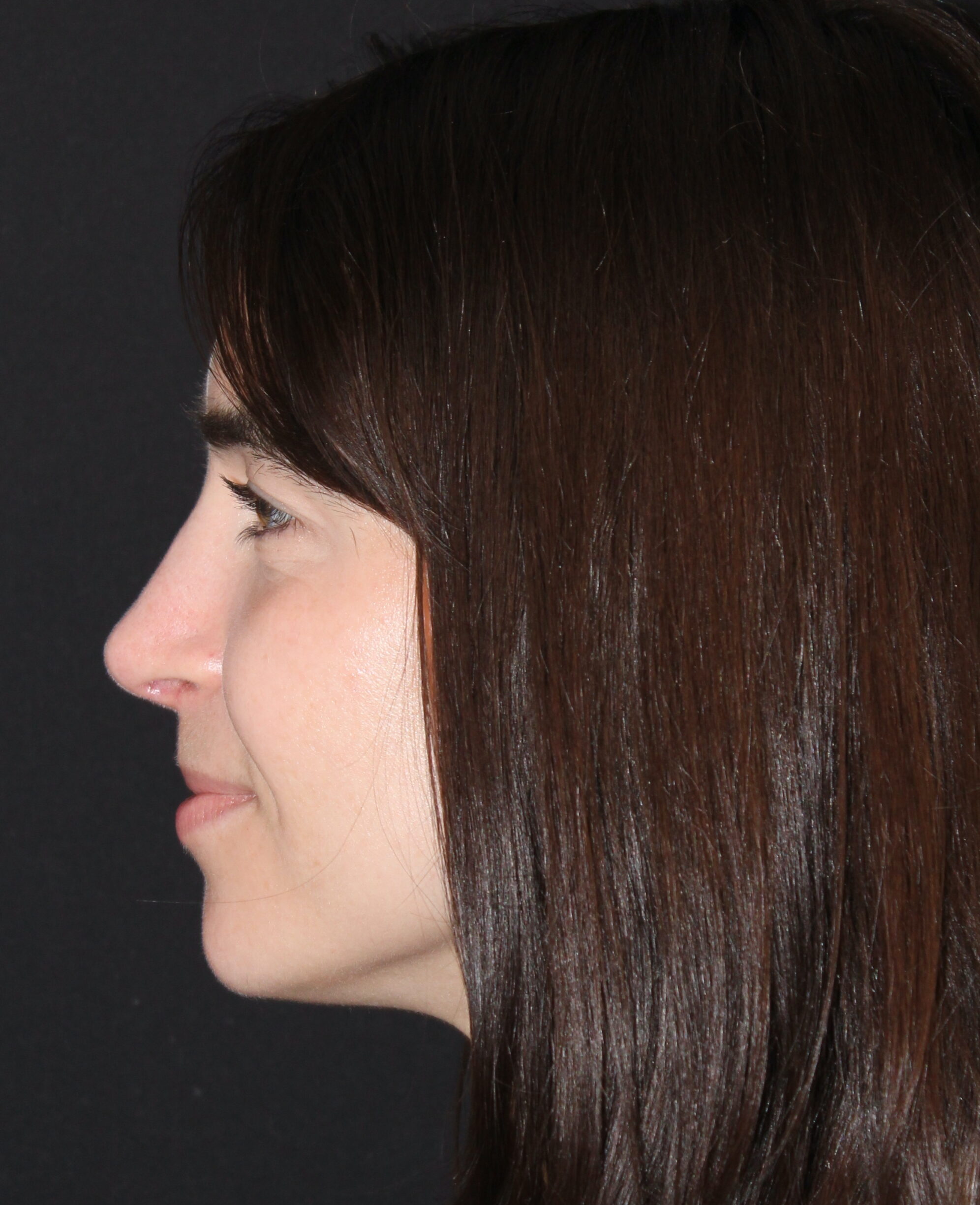 Patient #180 After Image