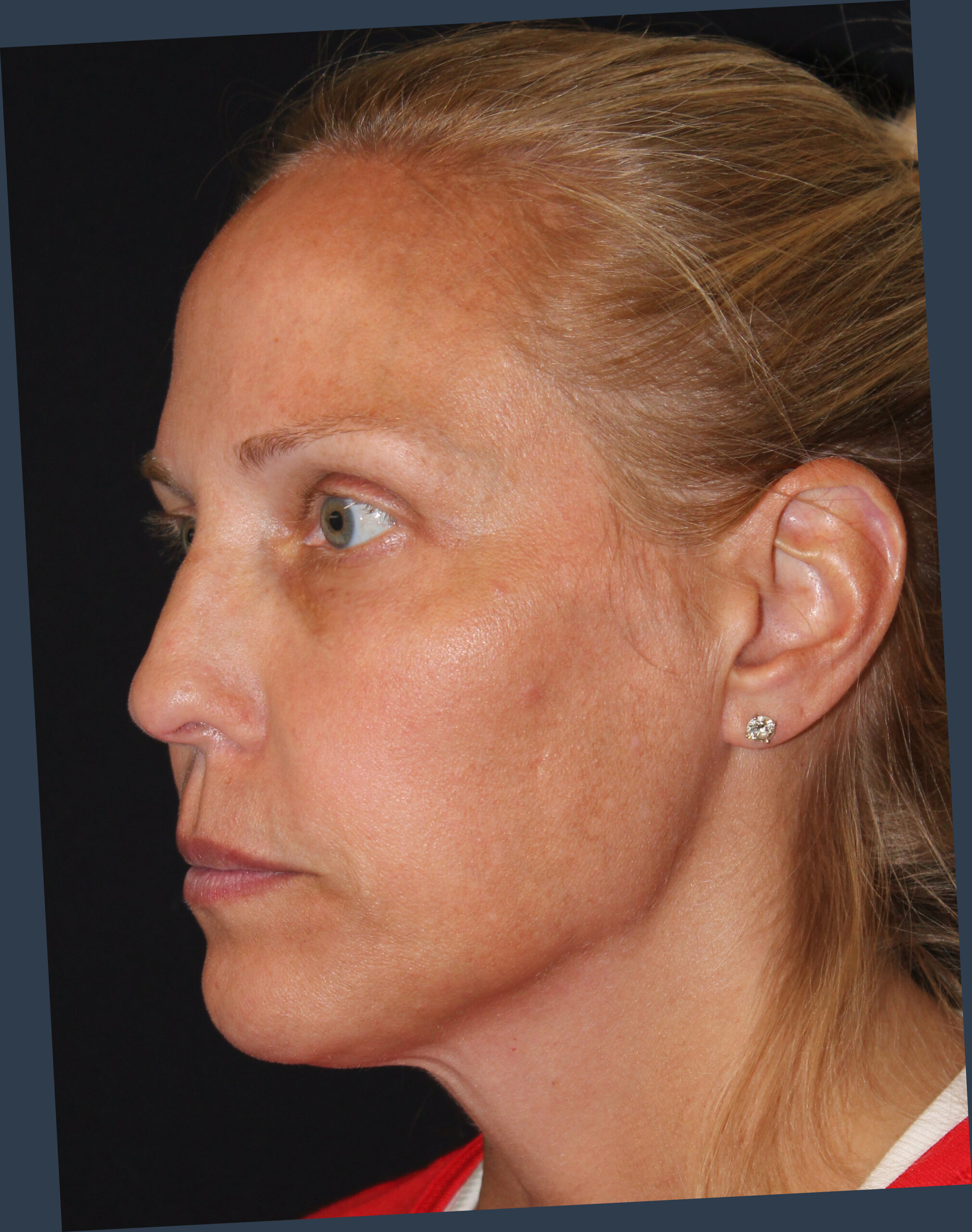 Patient 103 Before Image