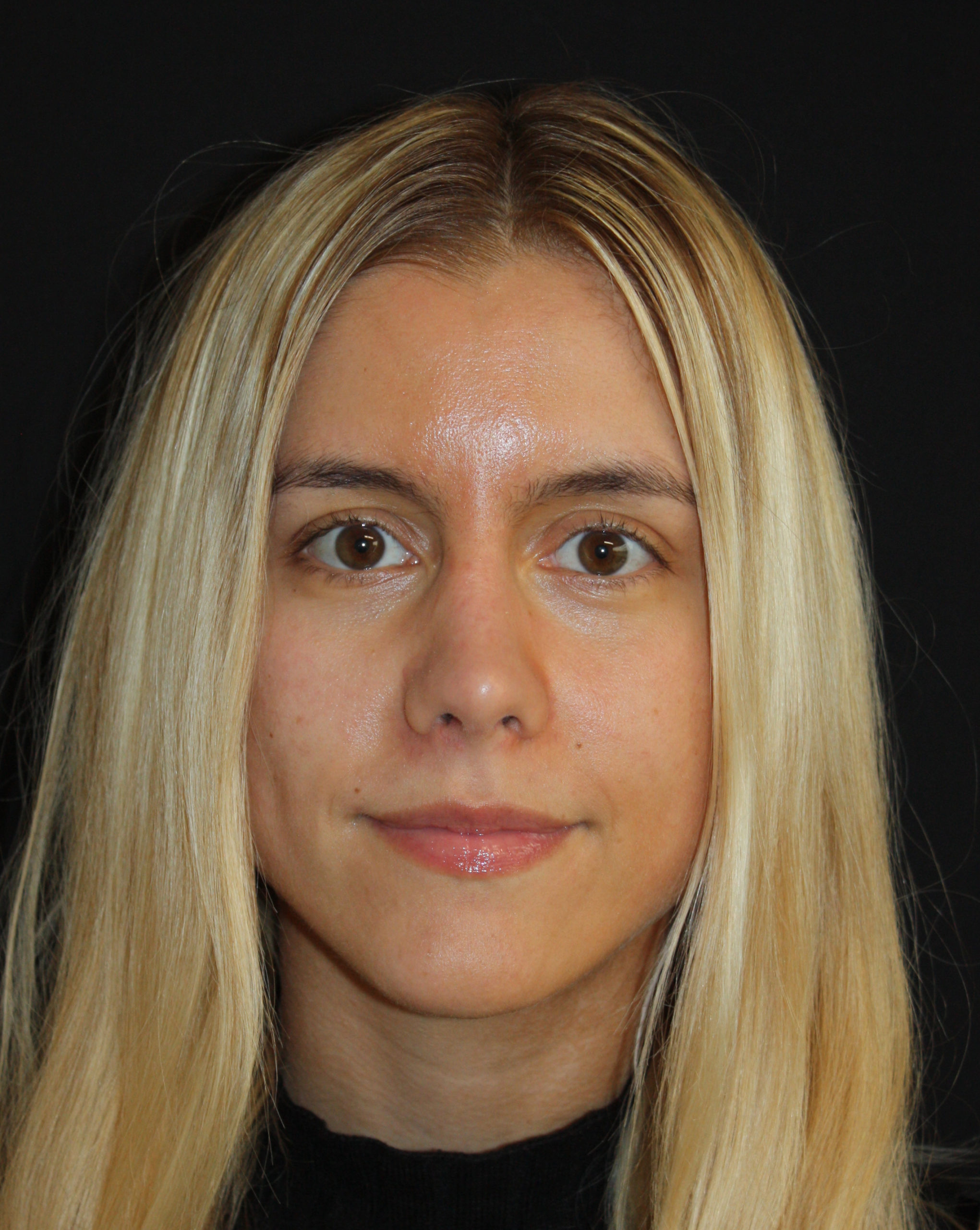 Patient 59 After Image