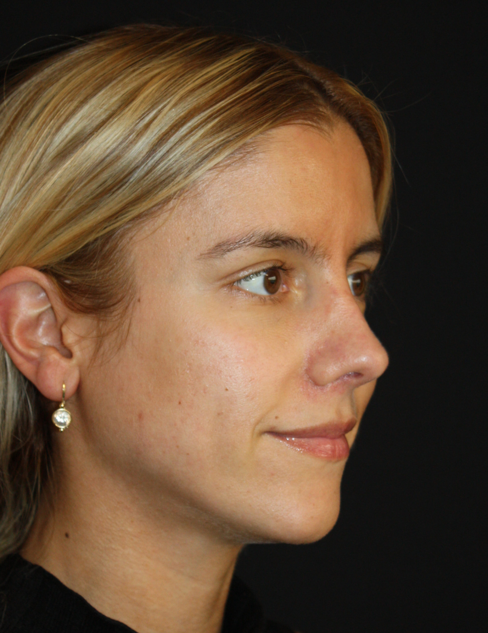 Patient 59 After Image