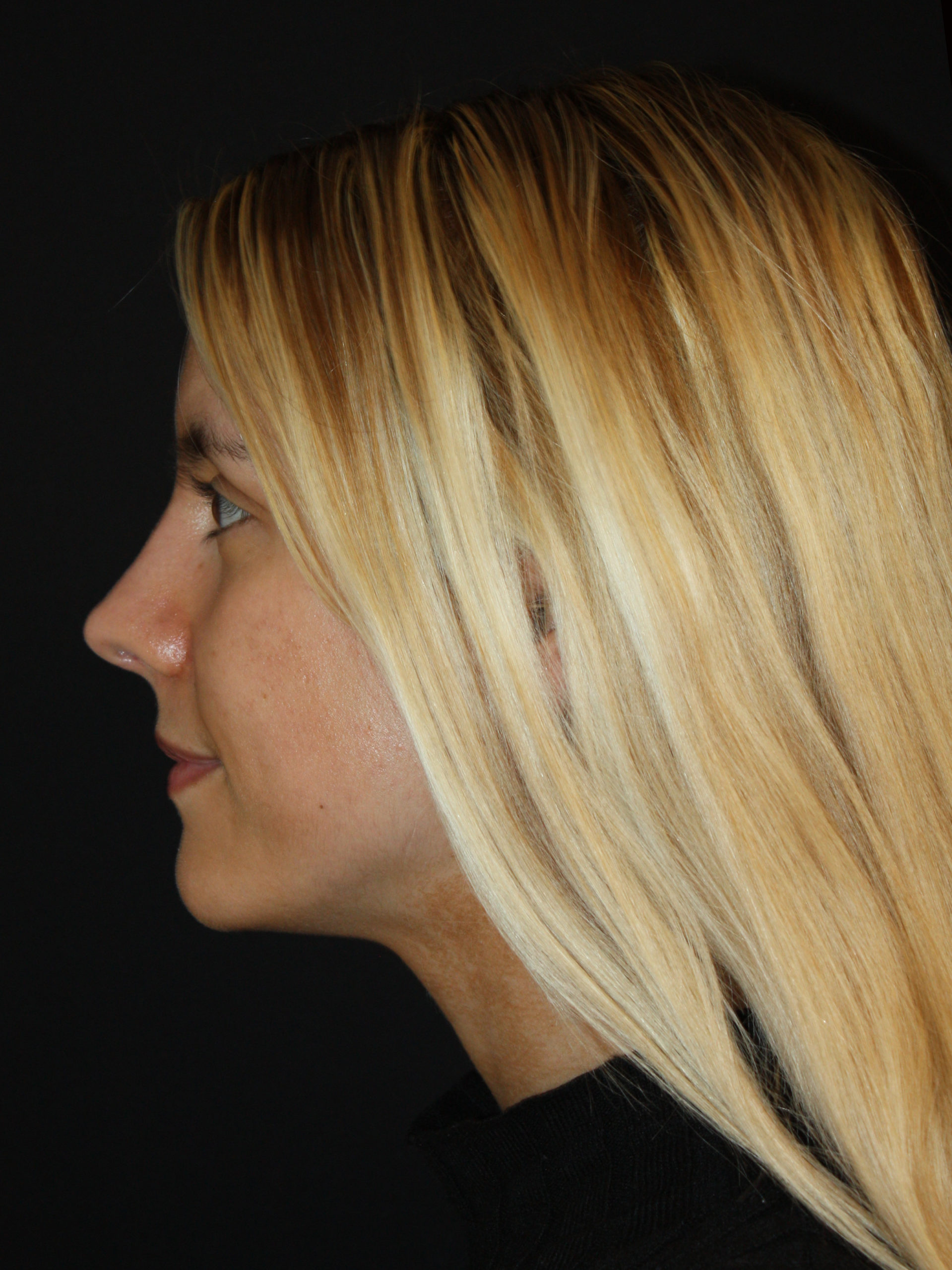 Patient 59 After Image