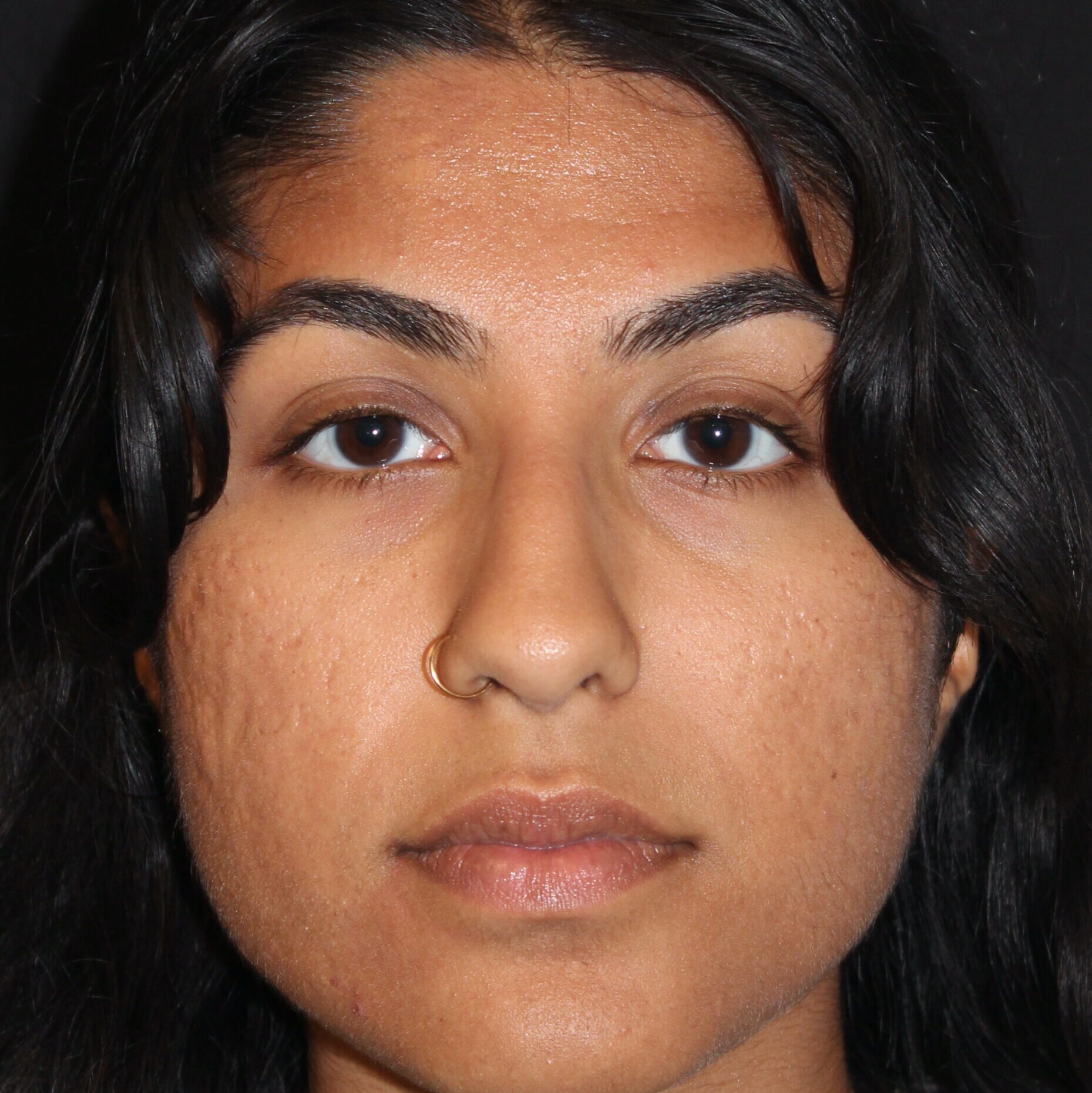 Patient #174 Before Image