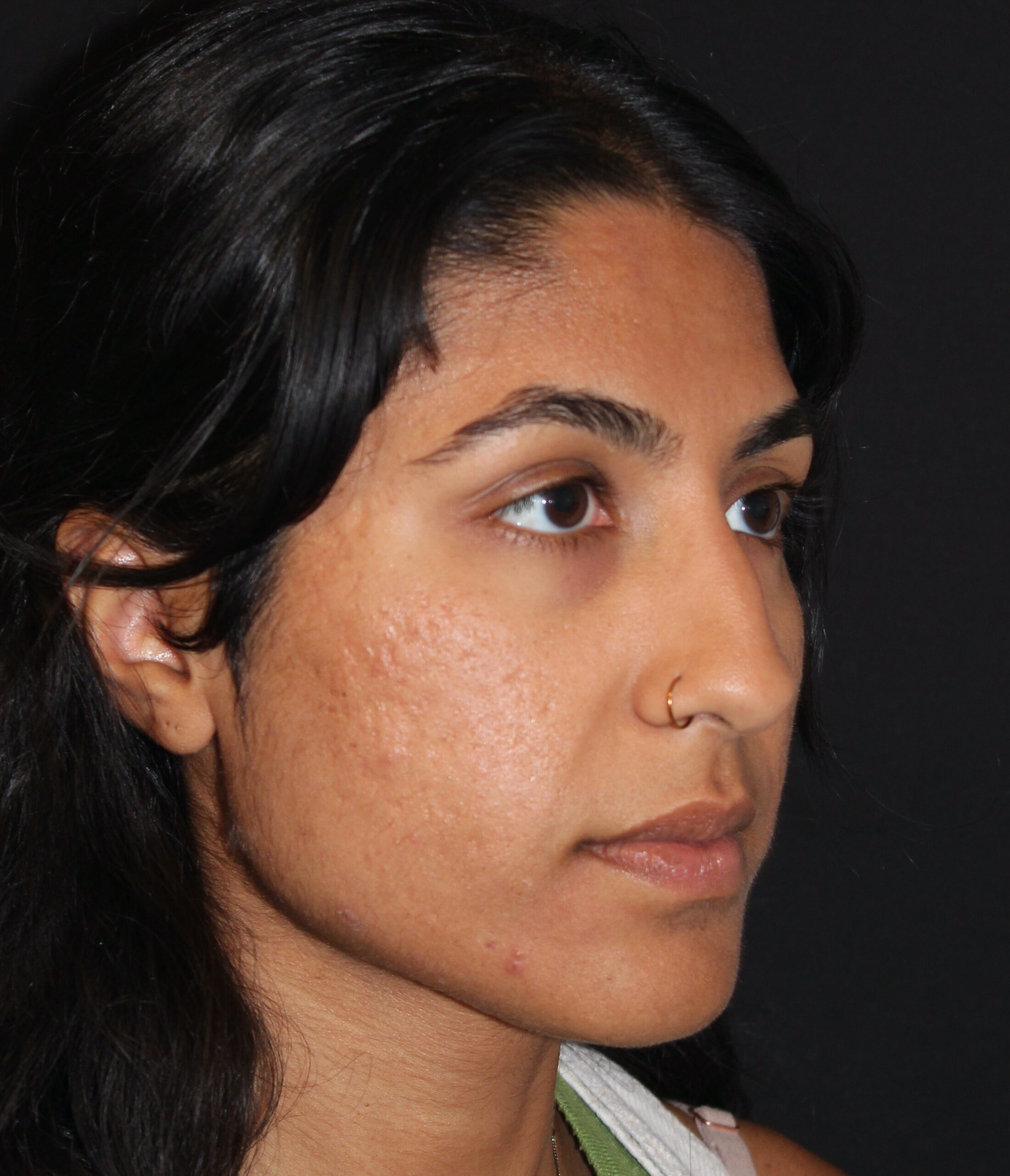 Patient #174 Before Image