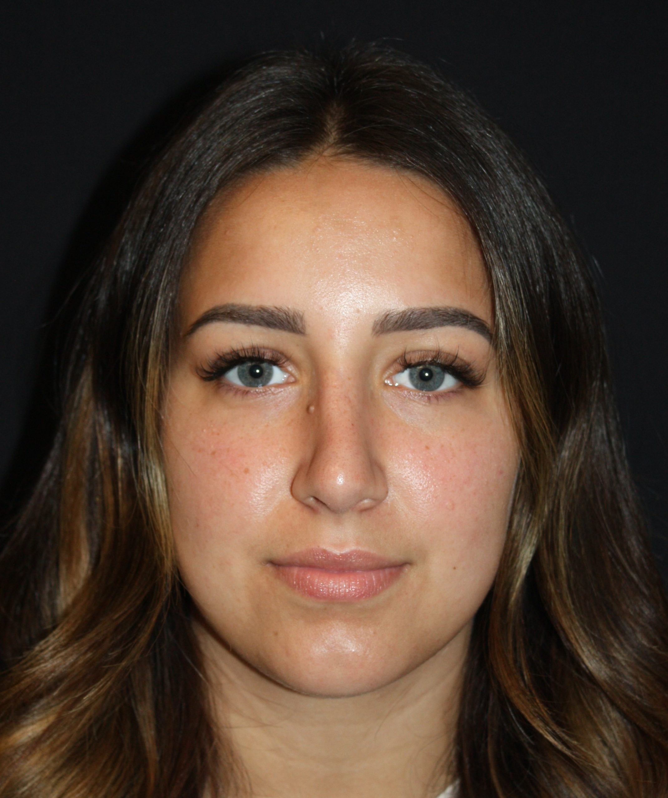 Patient 68 After Image