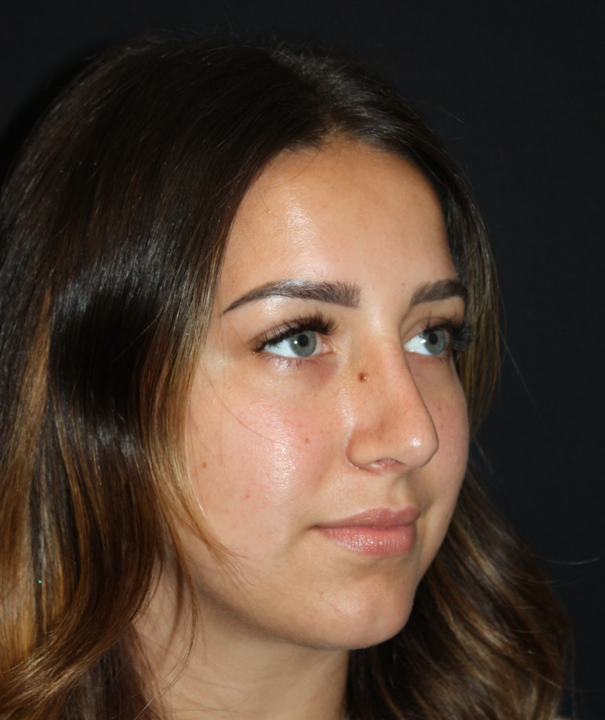 Patient 68 After Image