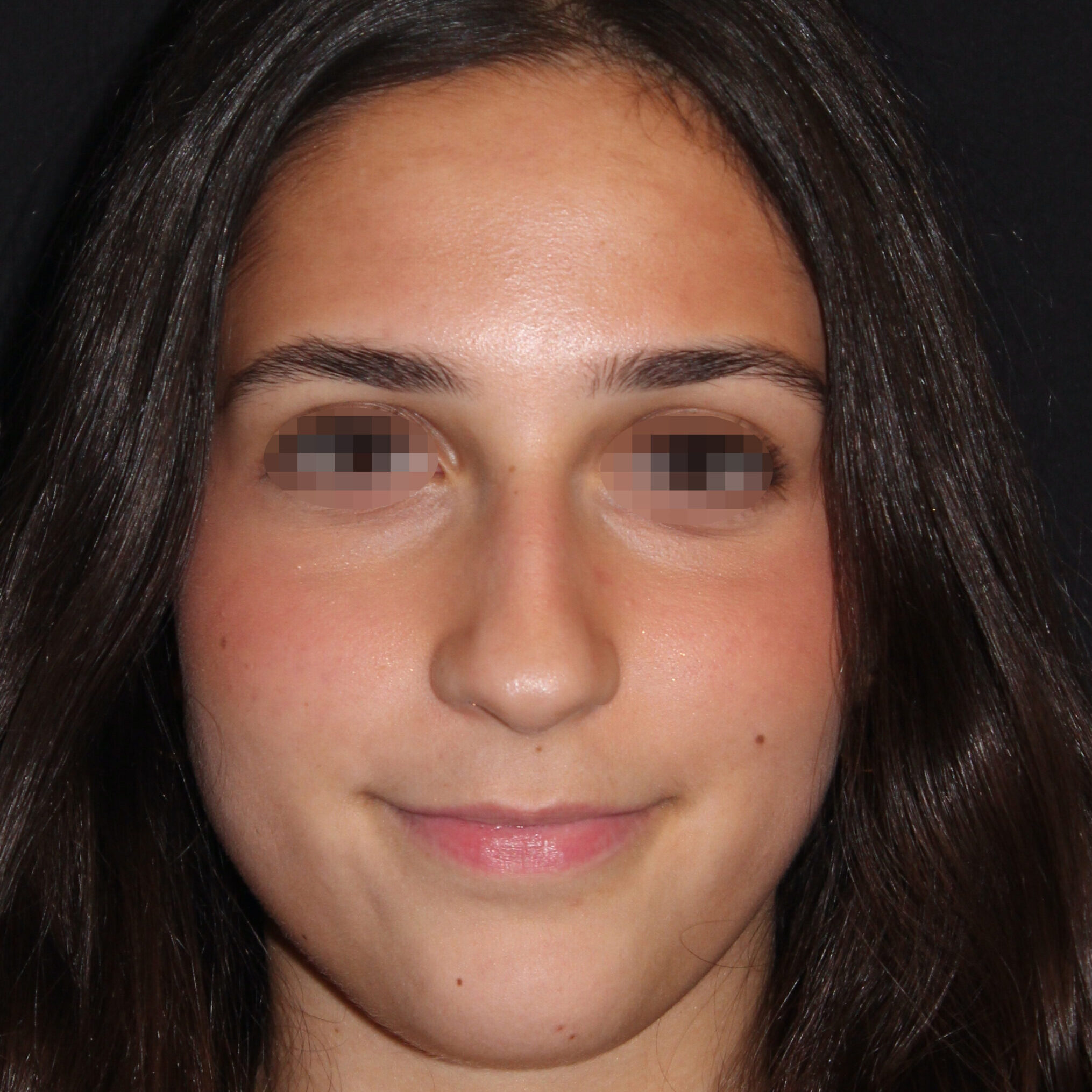 Patient #183 Before Image