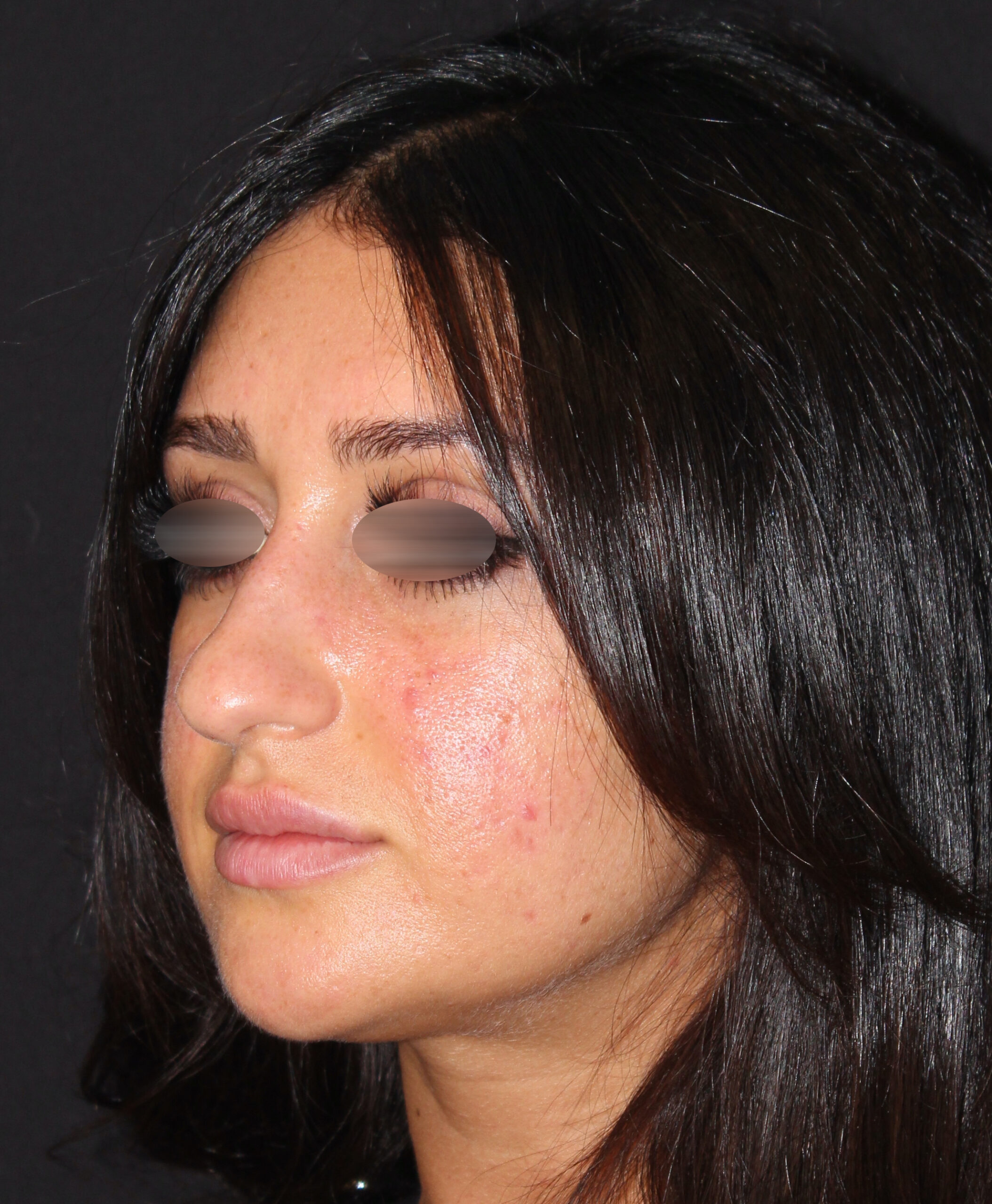 Patient #131 Before Image