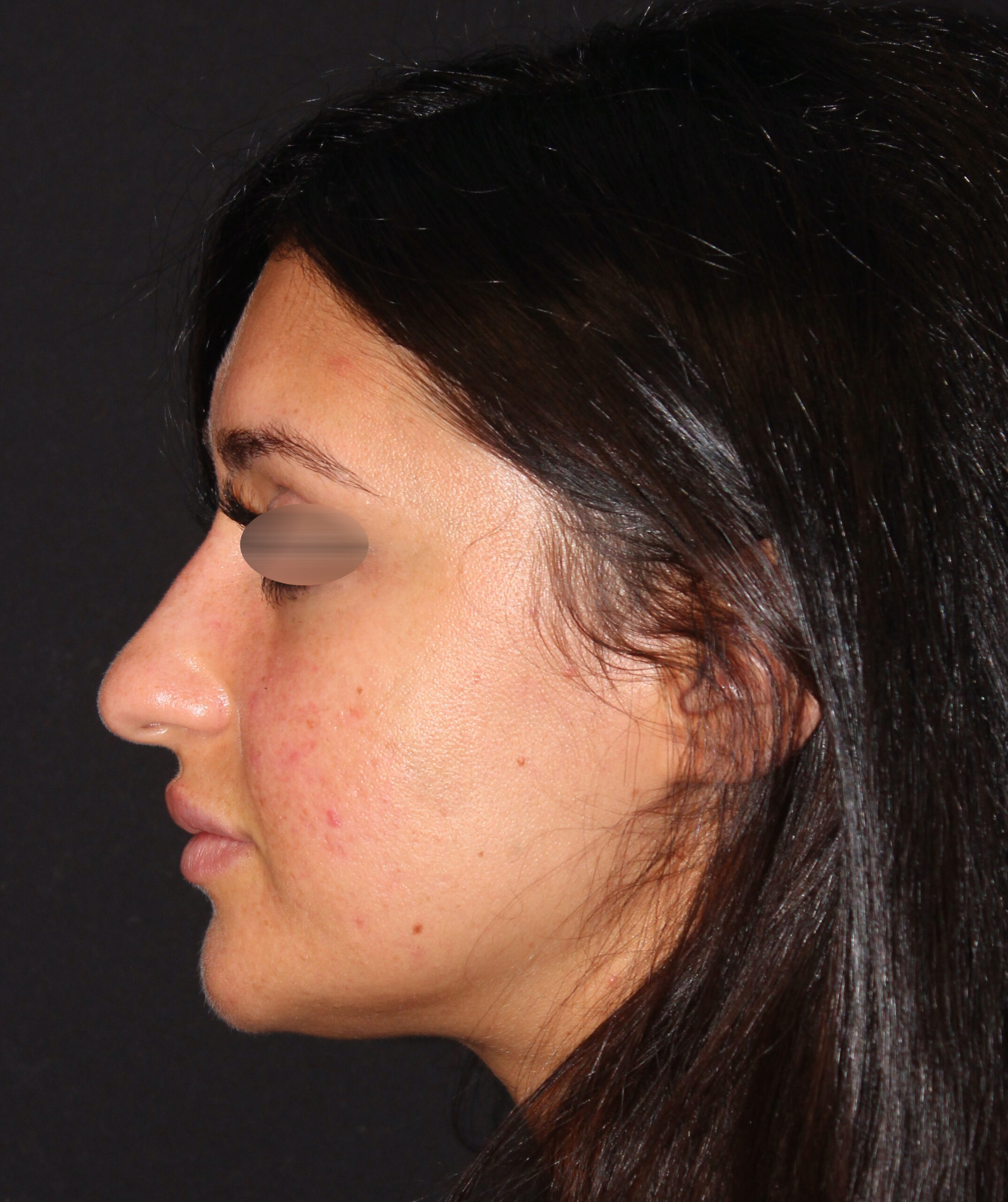 Patient #131 Before Image