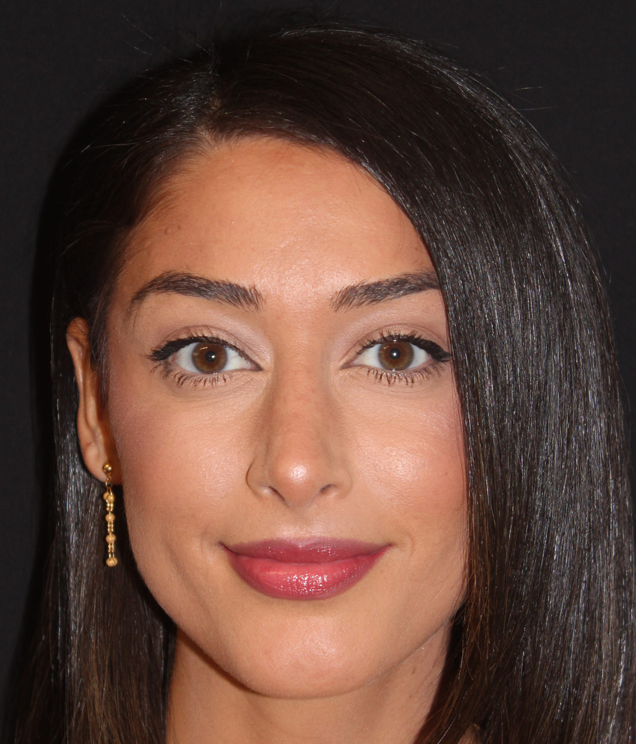 Patient 84 After Image