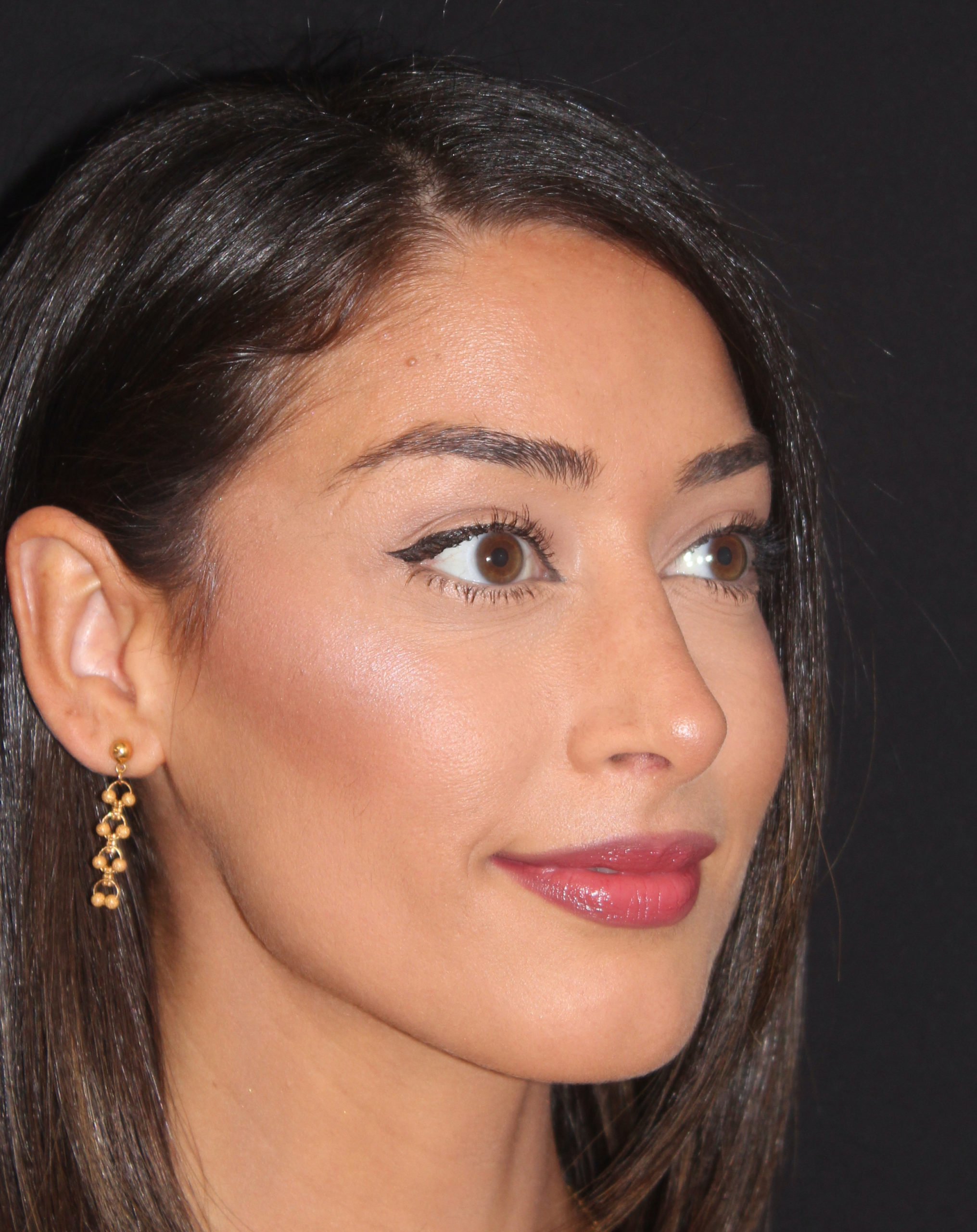 Patient 84 After Image