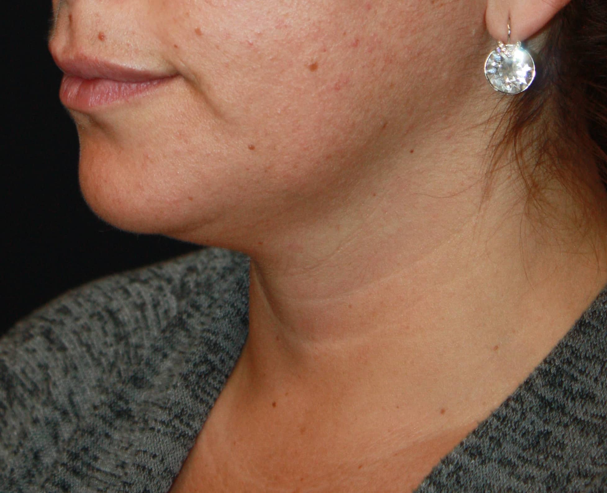 Patient 89 Before Image