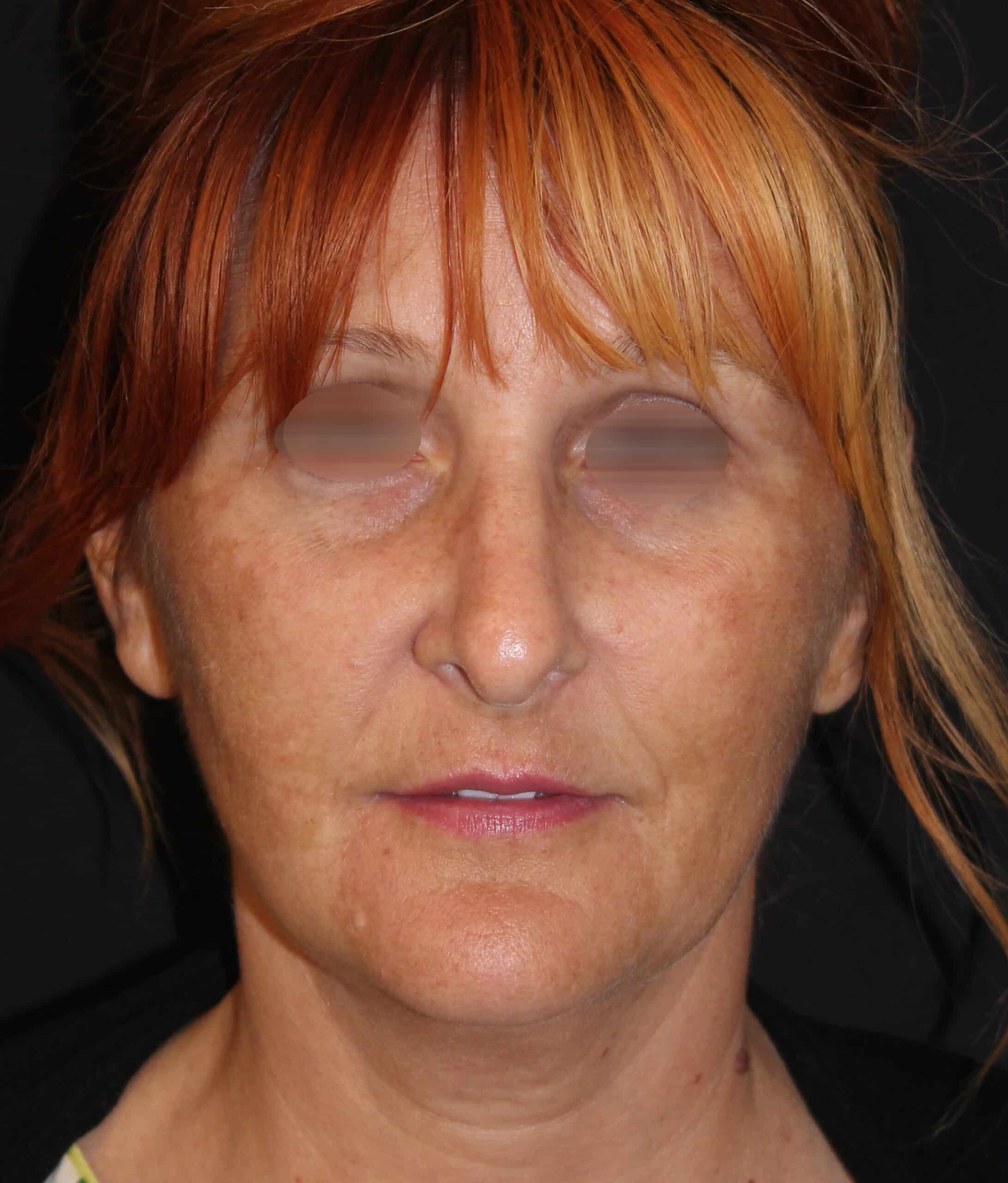 Patient 96 Before Image