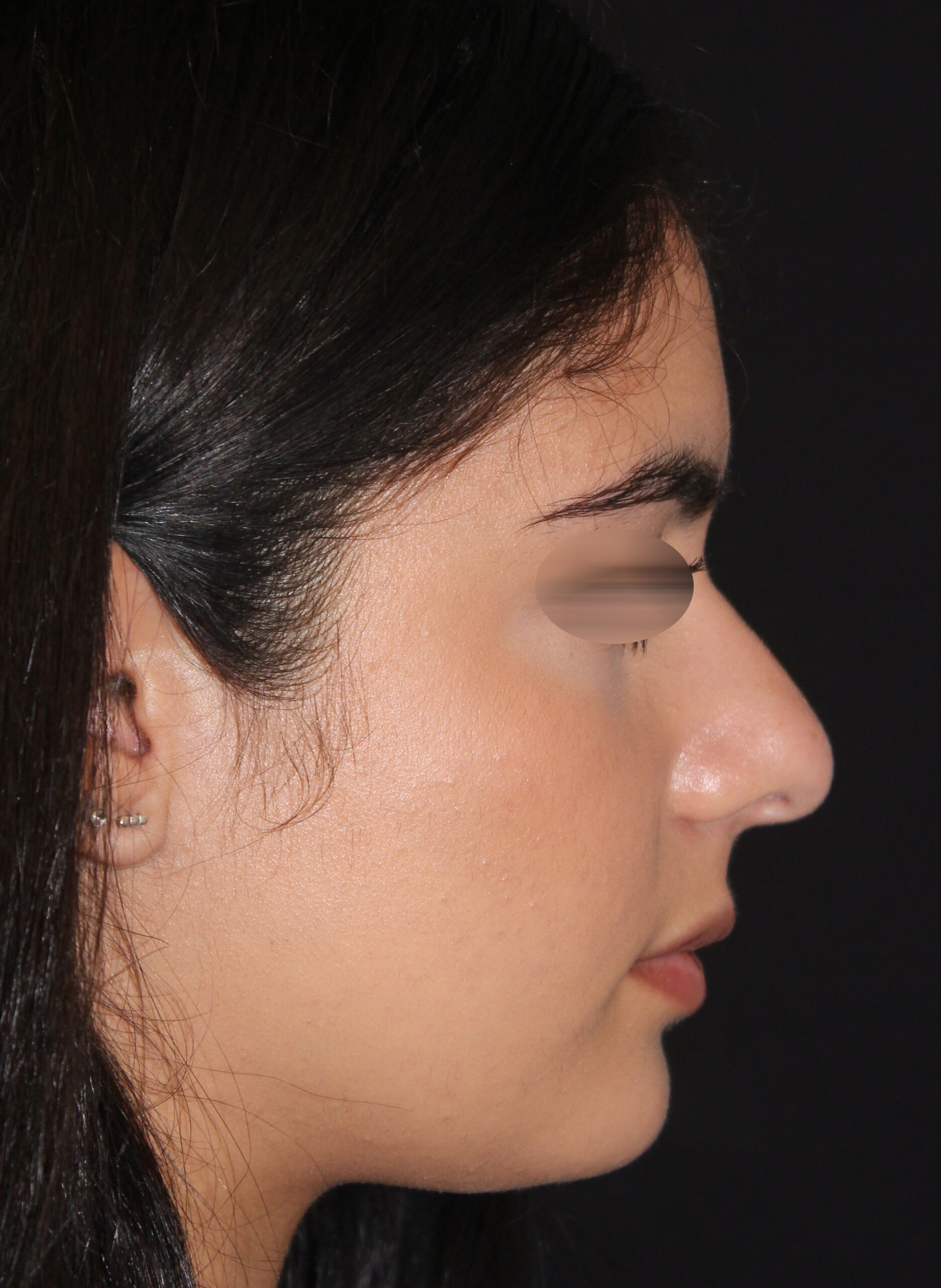 Patient #142 Before Image