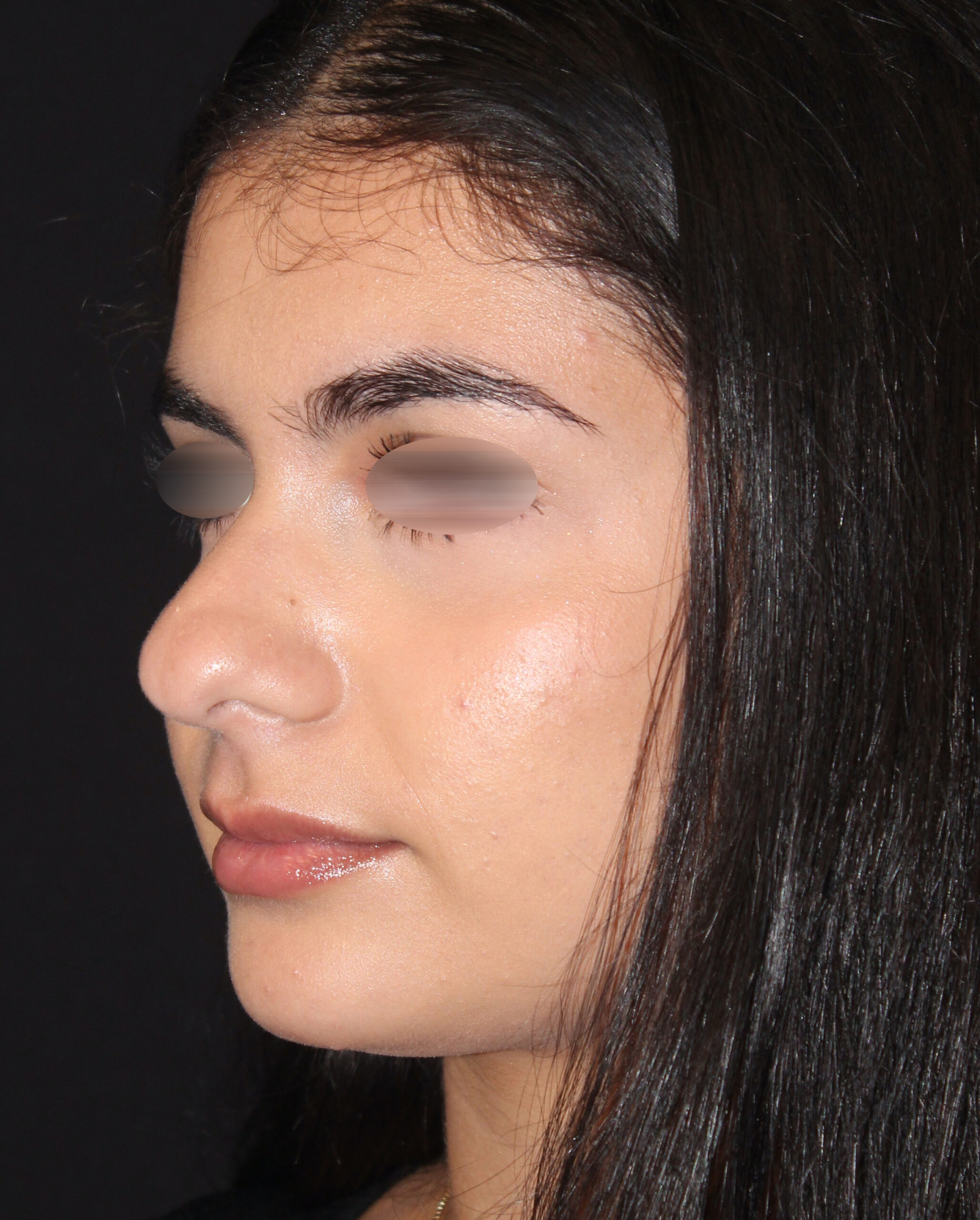 Patient #142 Before Image