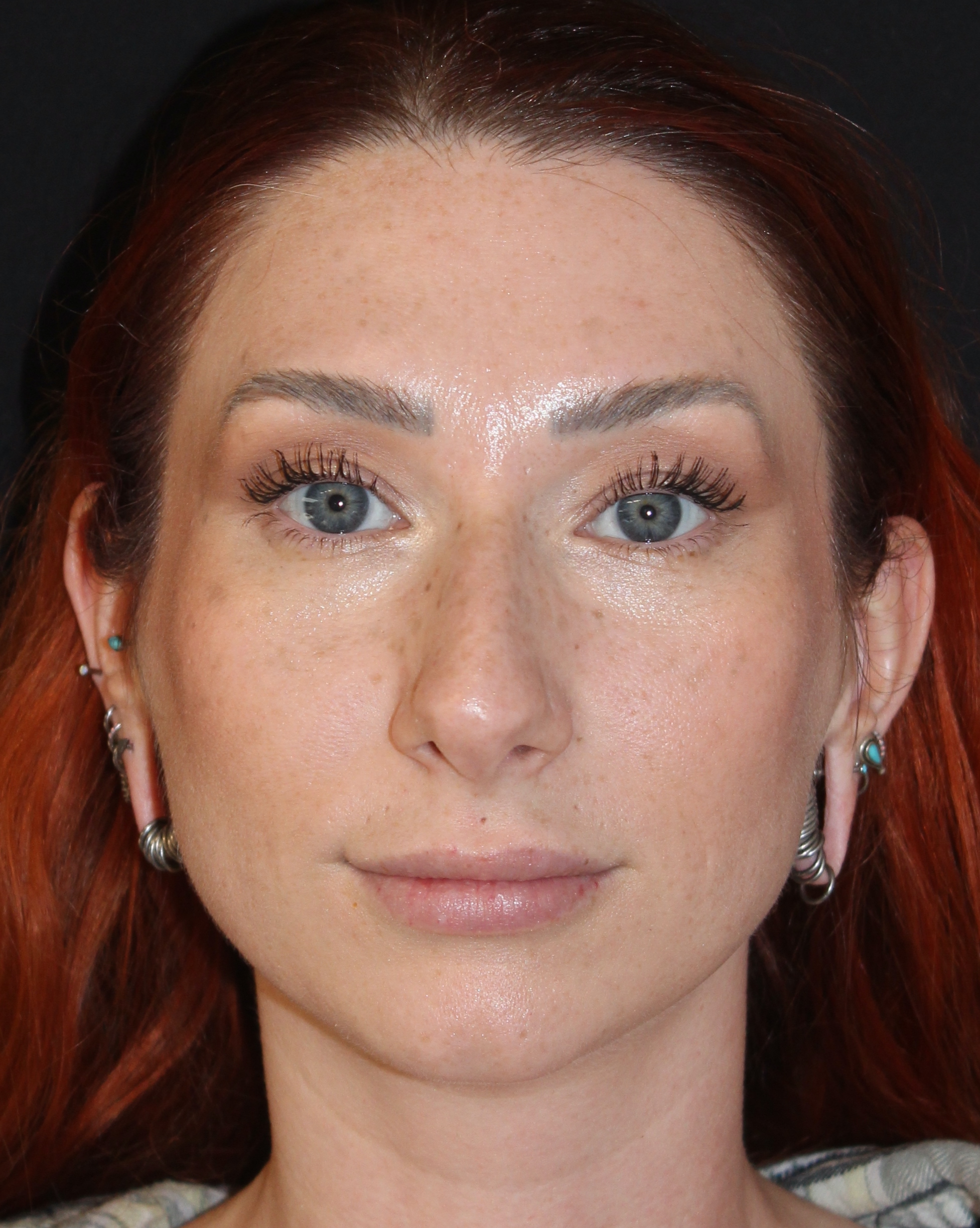 Patient #169 Before Image