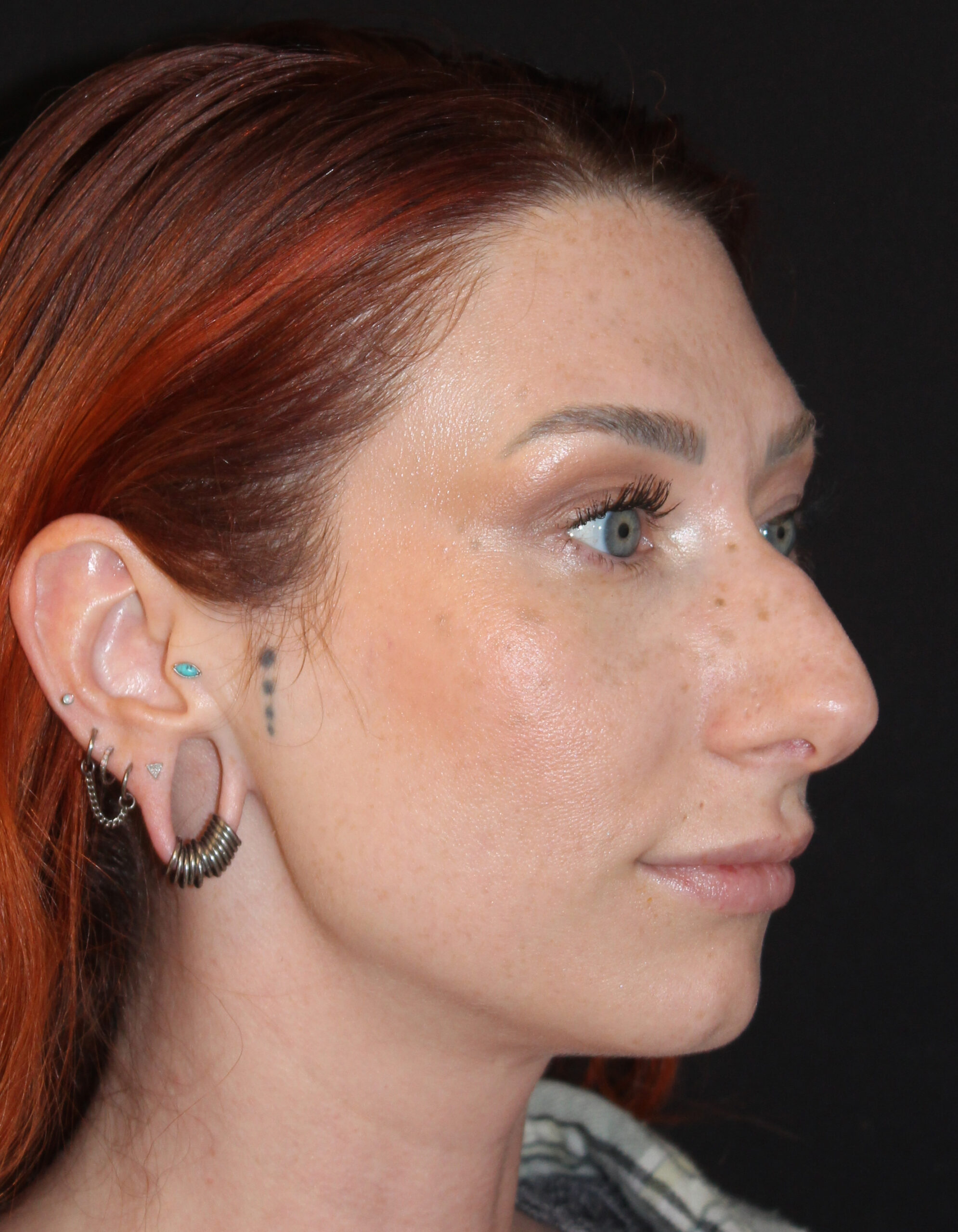 Patient #169 Before Image