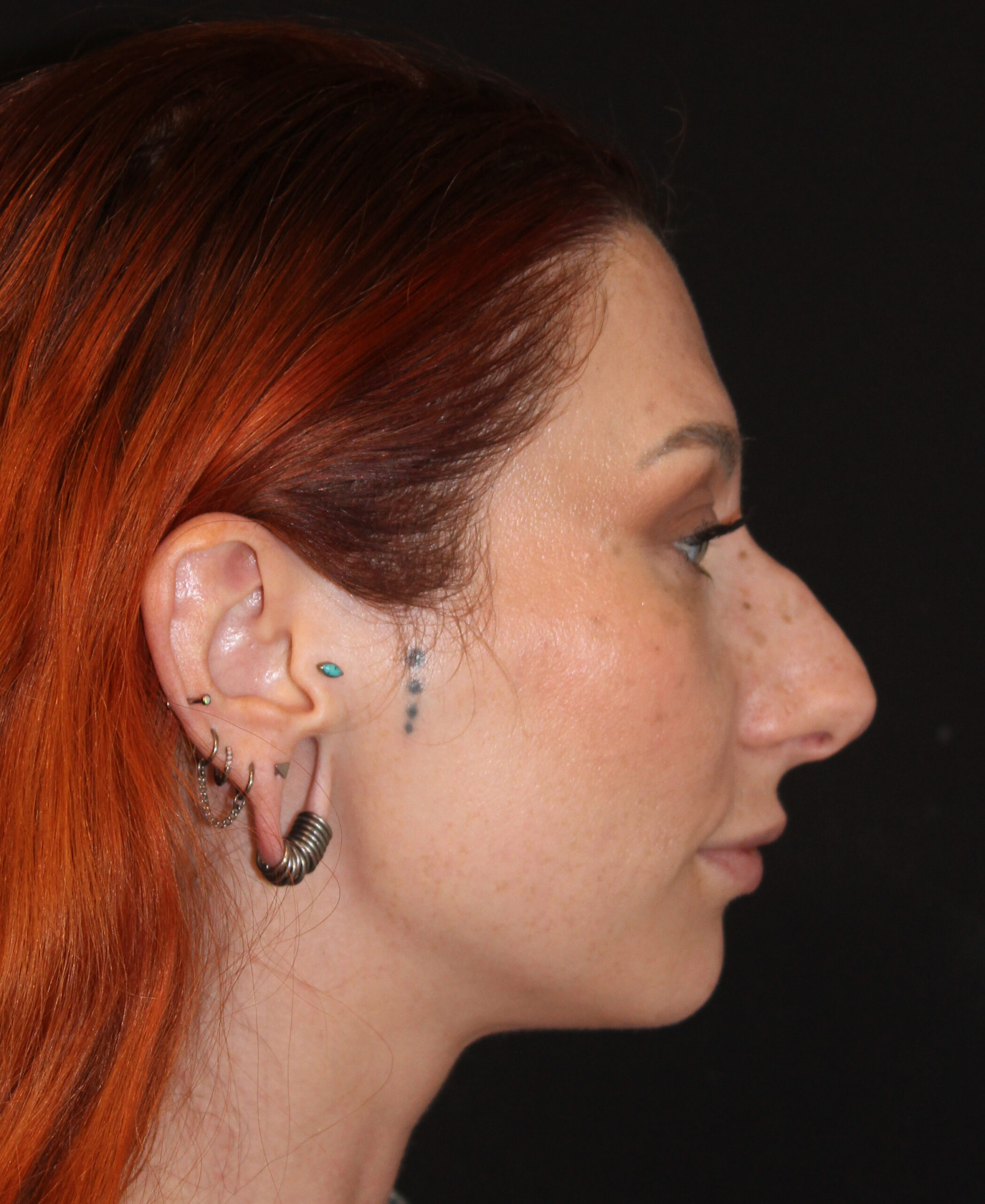 Patient #169 Before Image