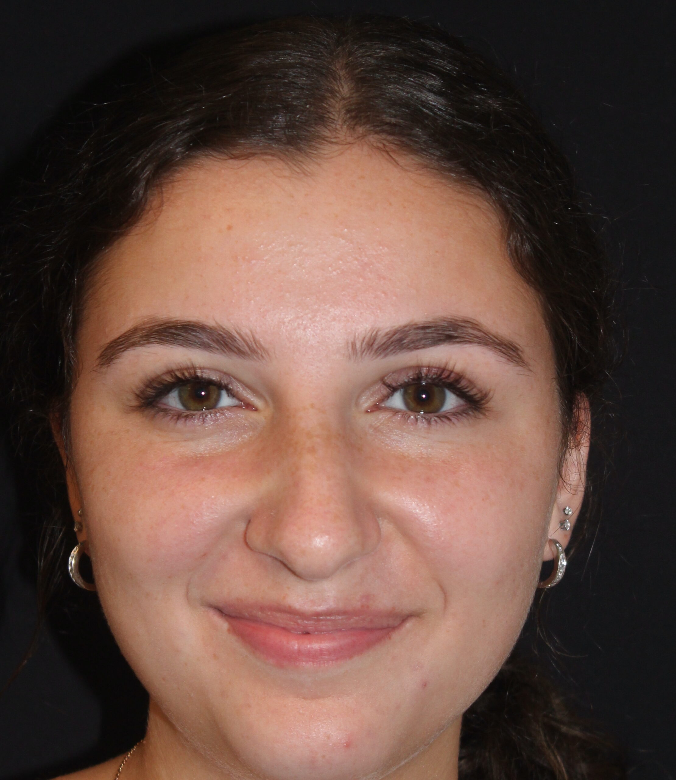 Patient #117 Before Image