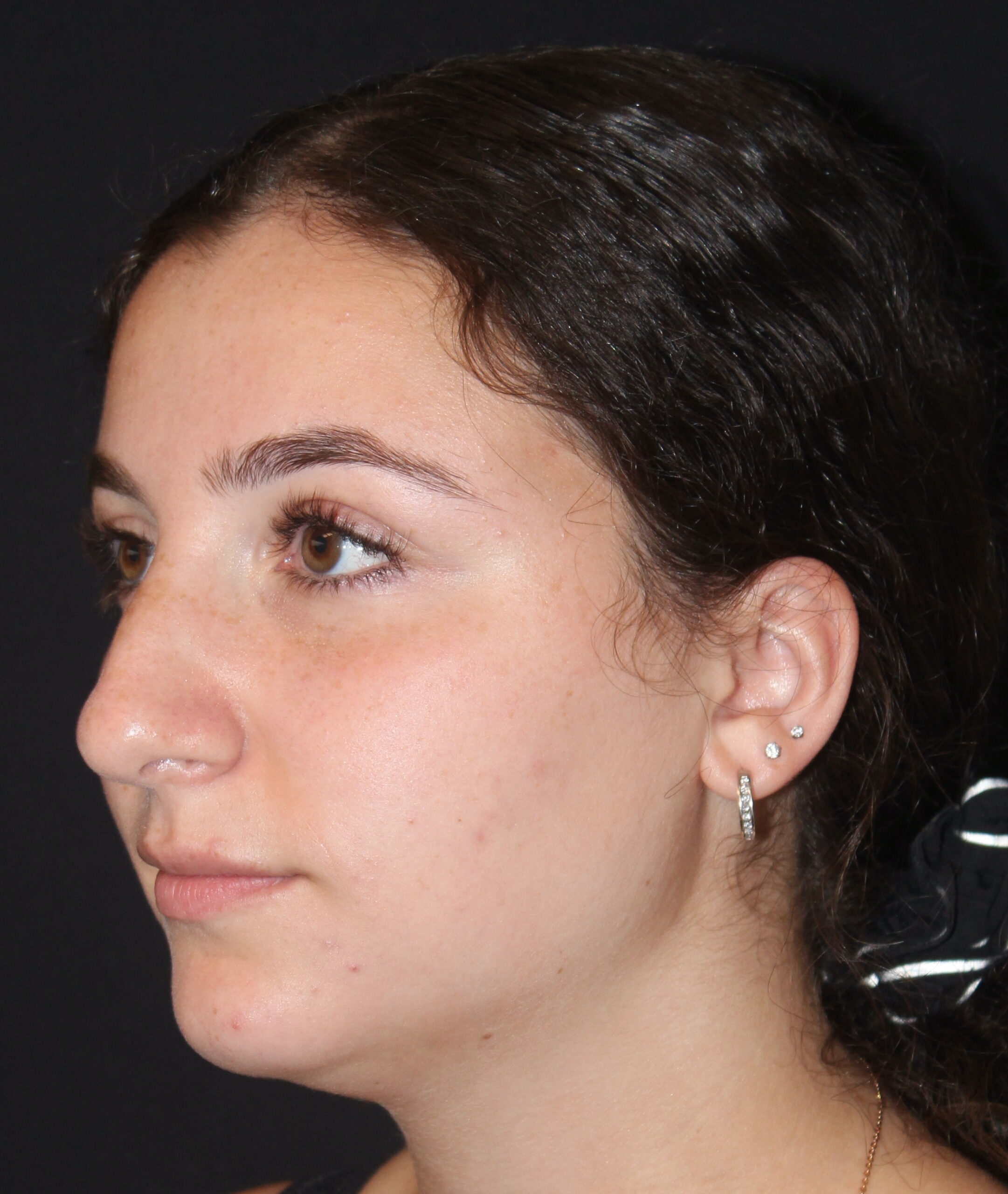 Patient #117 Before Image