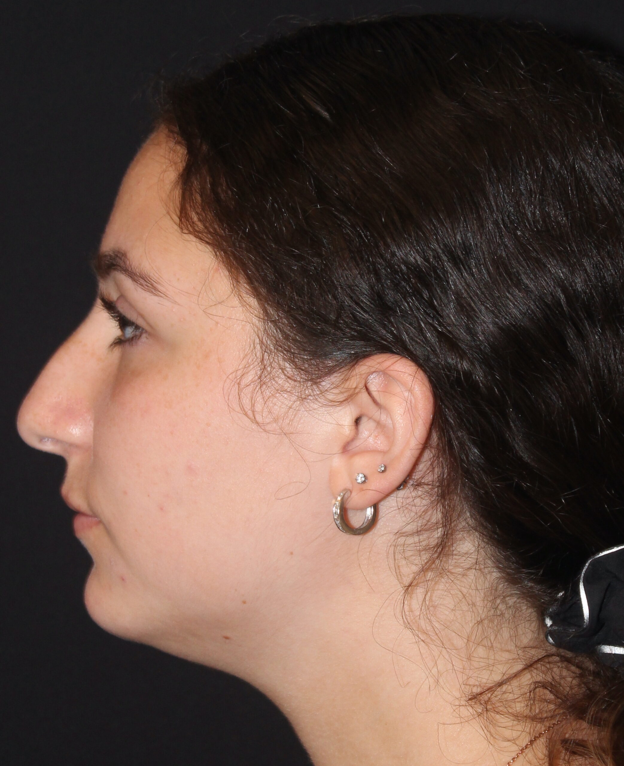 Patient #117 Before Image