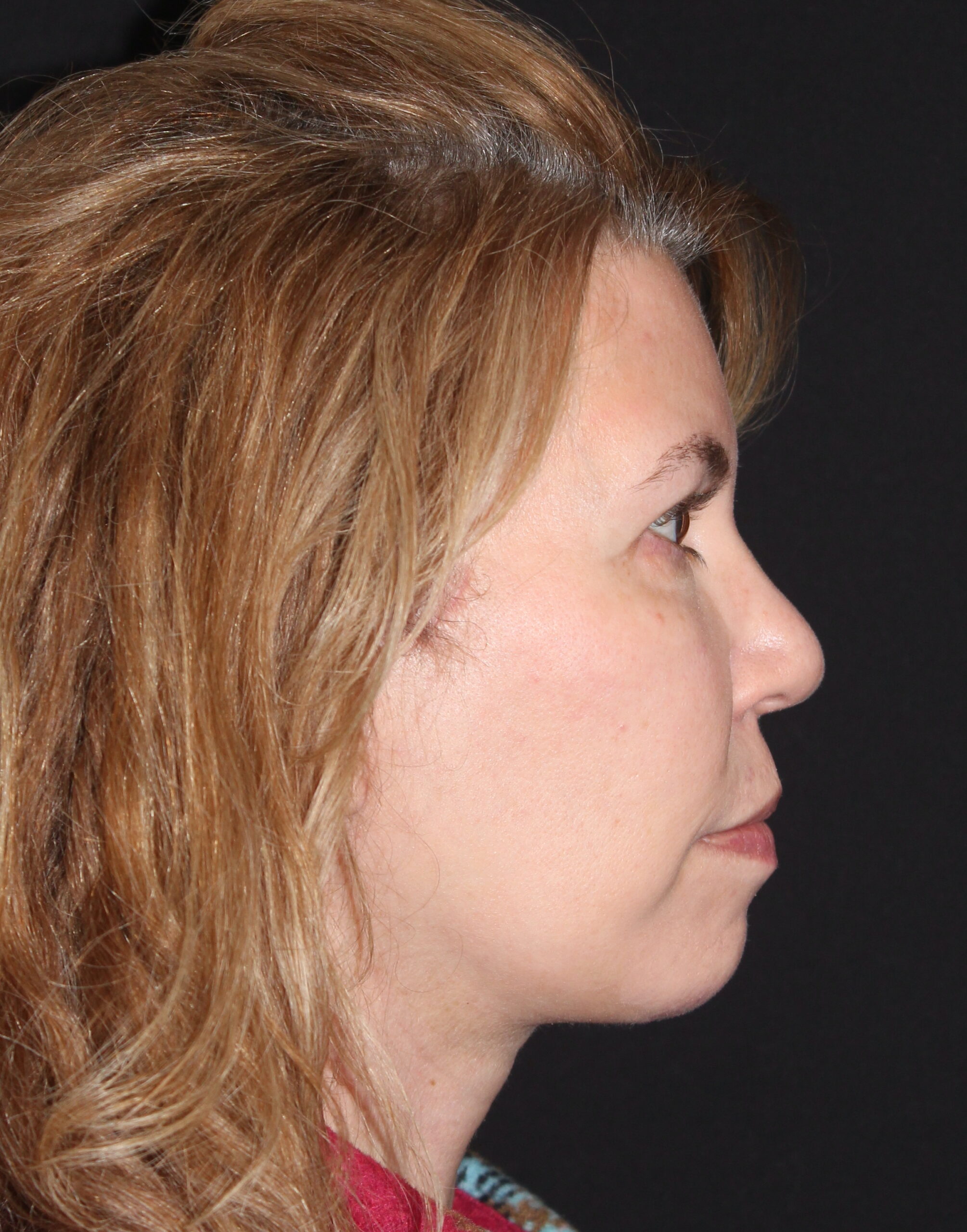 Patient 97 After Image