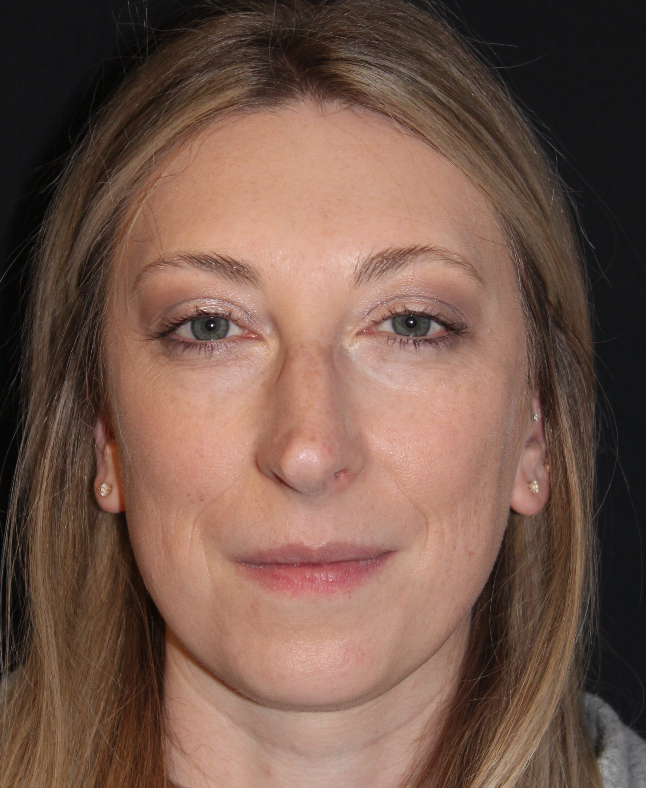 Patient #146 Before Image