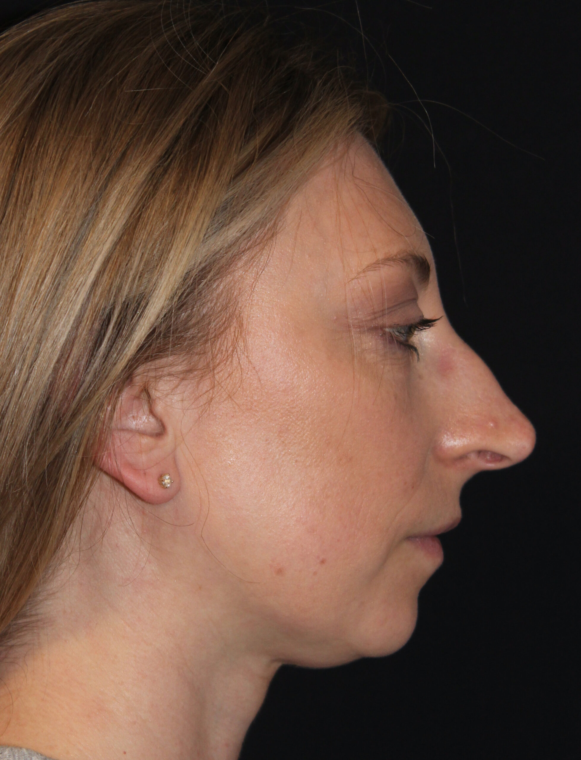 Patient #146 Before Image