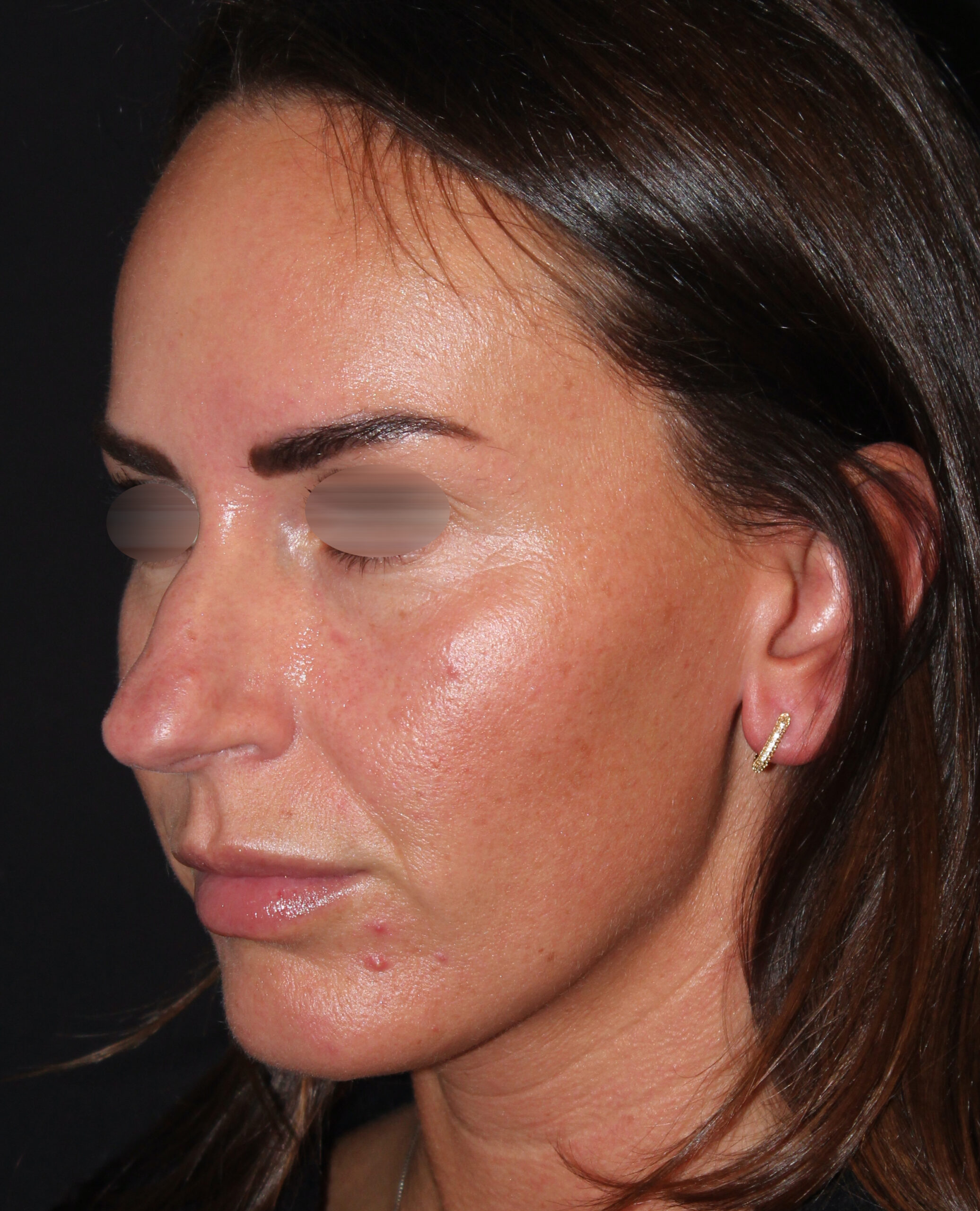 Patient 101 Before Image