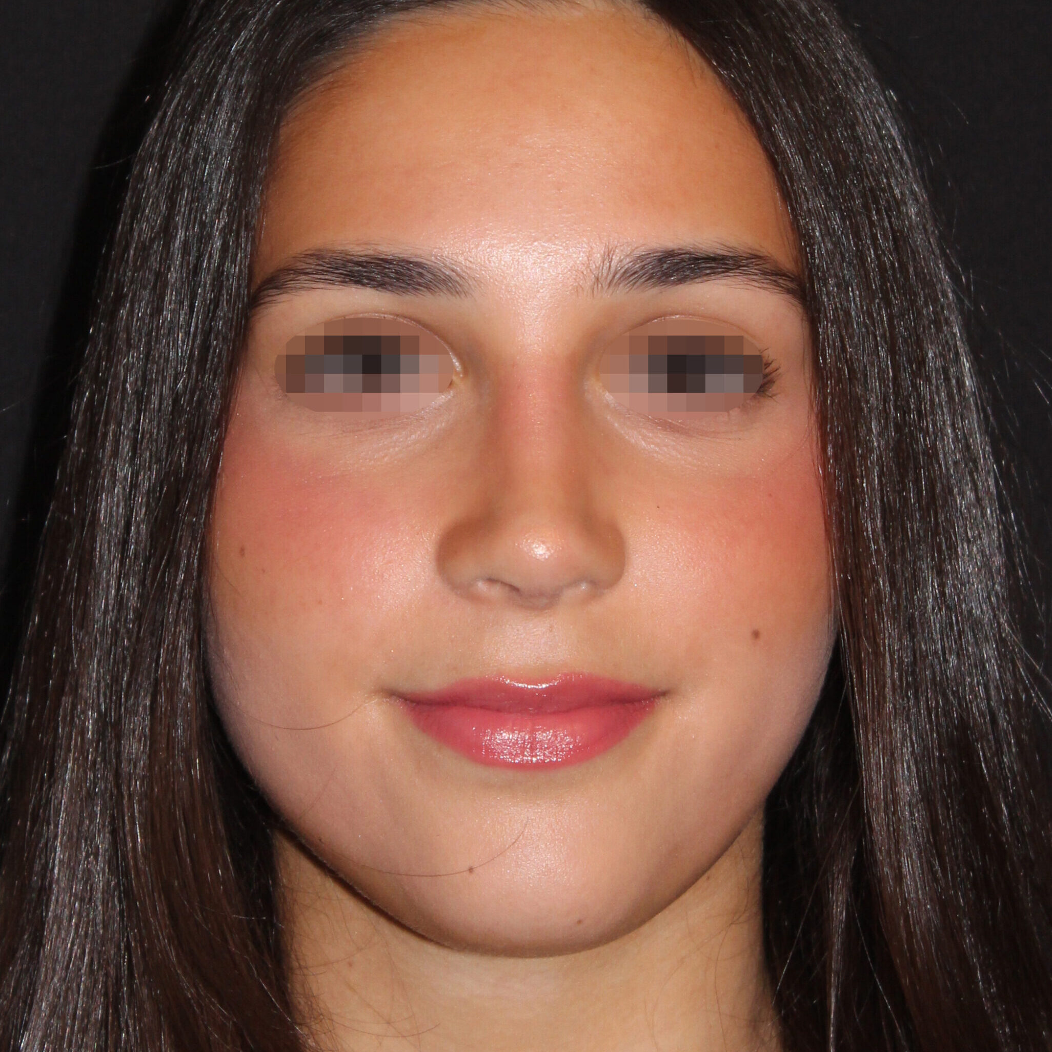 Patient #183 After Image